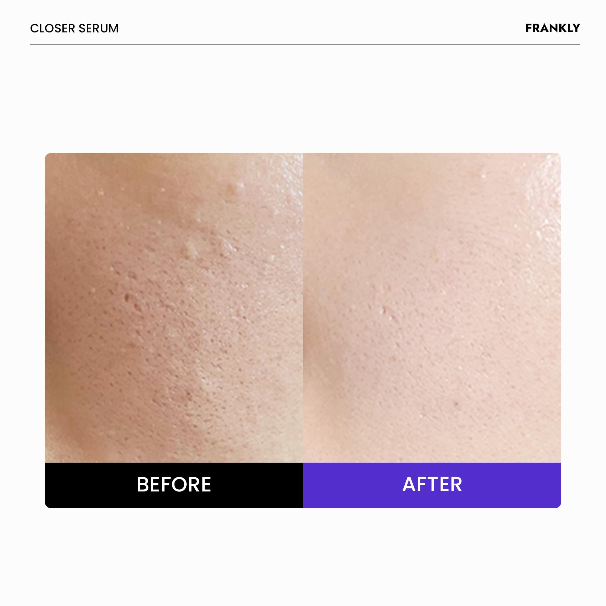 FRANKLY Deep Pore Treatment Duo: BHA & LHA Purifying Cleanser + 9 Peptide Pore Minimizing Serum Set | Hydrating, Anti-Aging Korean Skincare | Vegan & Cruelty-Free | For Oily, Acne-Prone Skin & Pore Refining | Daily Facial Cleansing & Anti-Wrinkle Routine