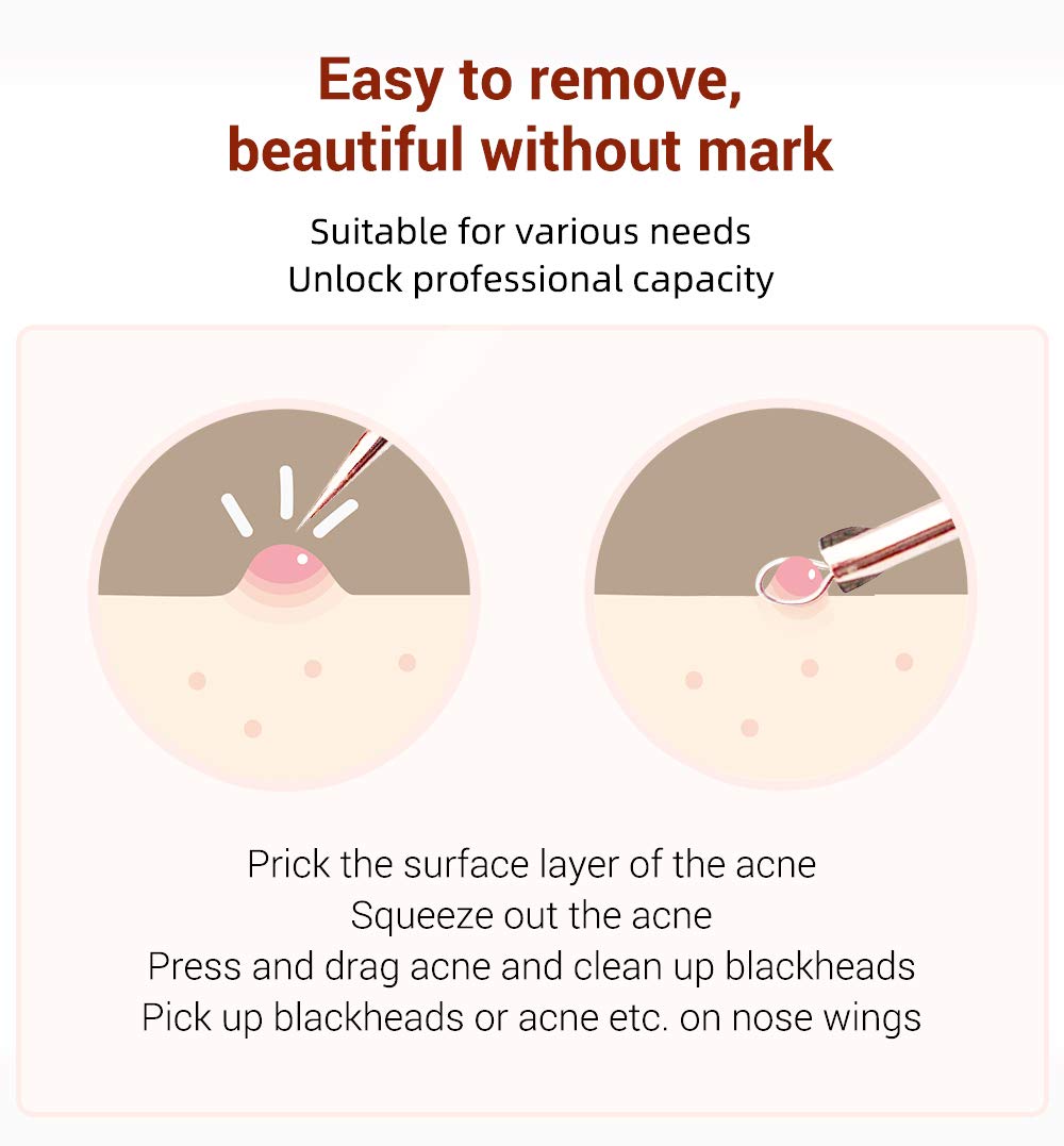 Professional 4-Piece Blackhead & Whitehead Remover Kit - Acne Pimple Extractor Tools Set with Comedone Blemish Removal (Rose Gold) for Clear Skin Care & Facial Treatment at Home