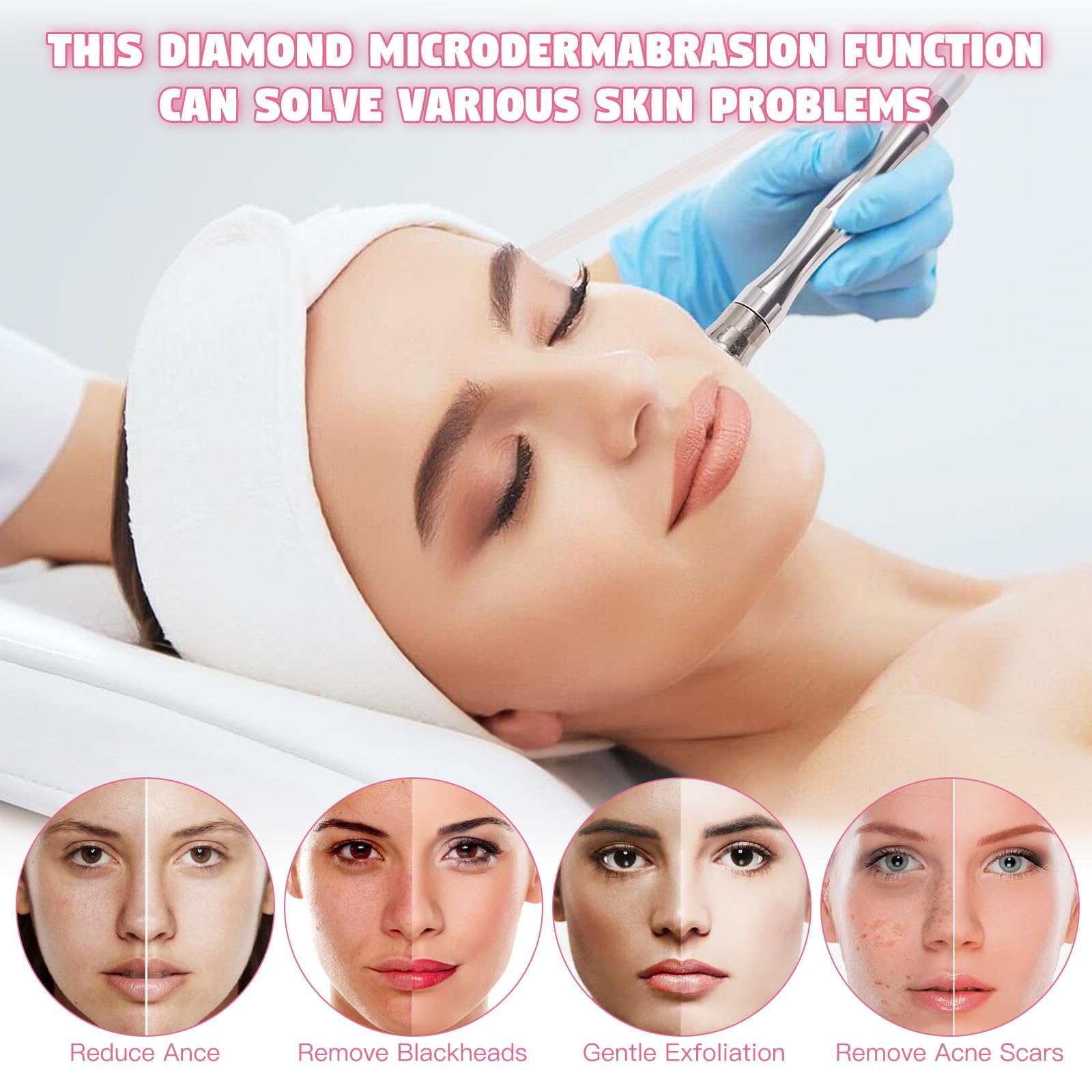 Professional 3-in-1 Microdermabrasion Machine with 65-68cmhg Vacuum Suction - Diamond Facial Cleaner for Home & Salon Use | Beauty Star Skin Care Equipment with Vacuum & Spray Gun | Perfect for Acne Treatment, Blackhead Removal & Anti-Aging Skincare Routine