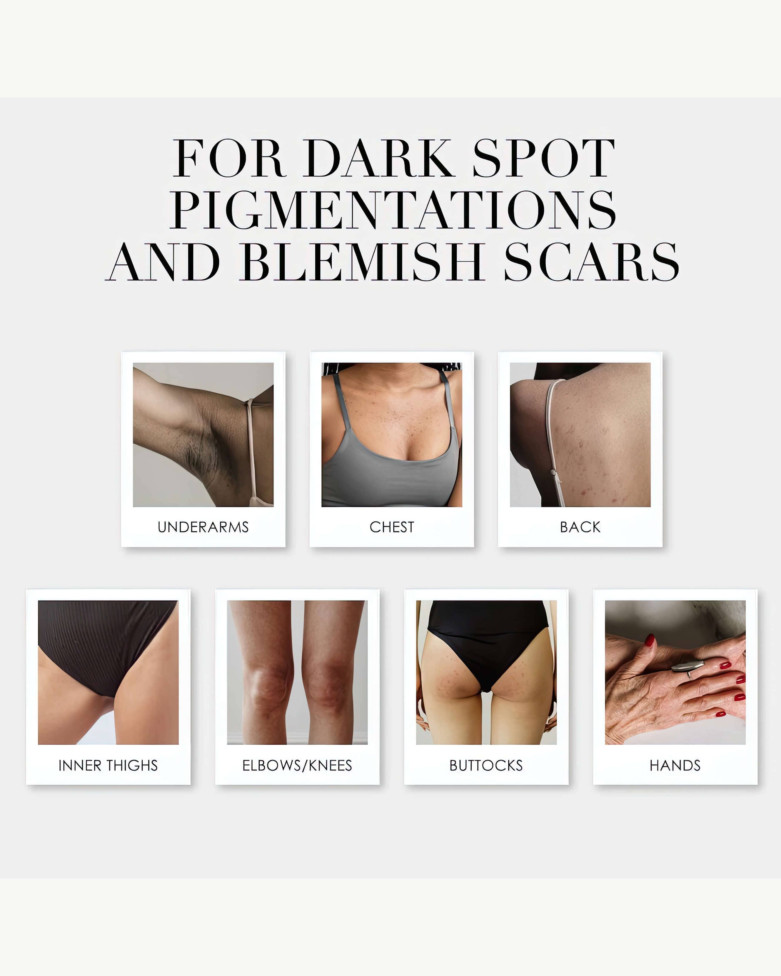 Kojic Acid Brightening Body Bar - The Takesumi Bright Soap for Skin Lightening & Even Tone | Perfect for Dark Spots, Hyperpigmentation & Glowing Skin