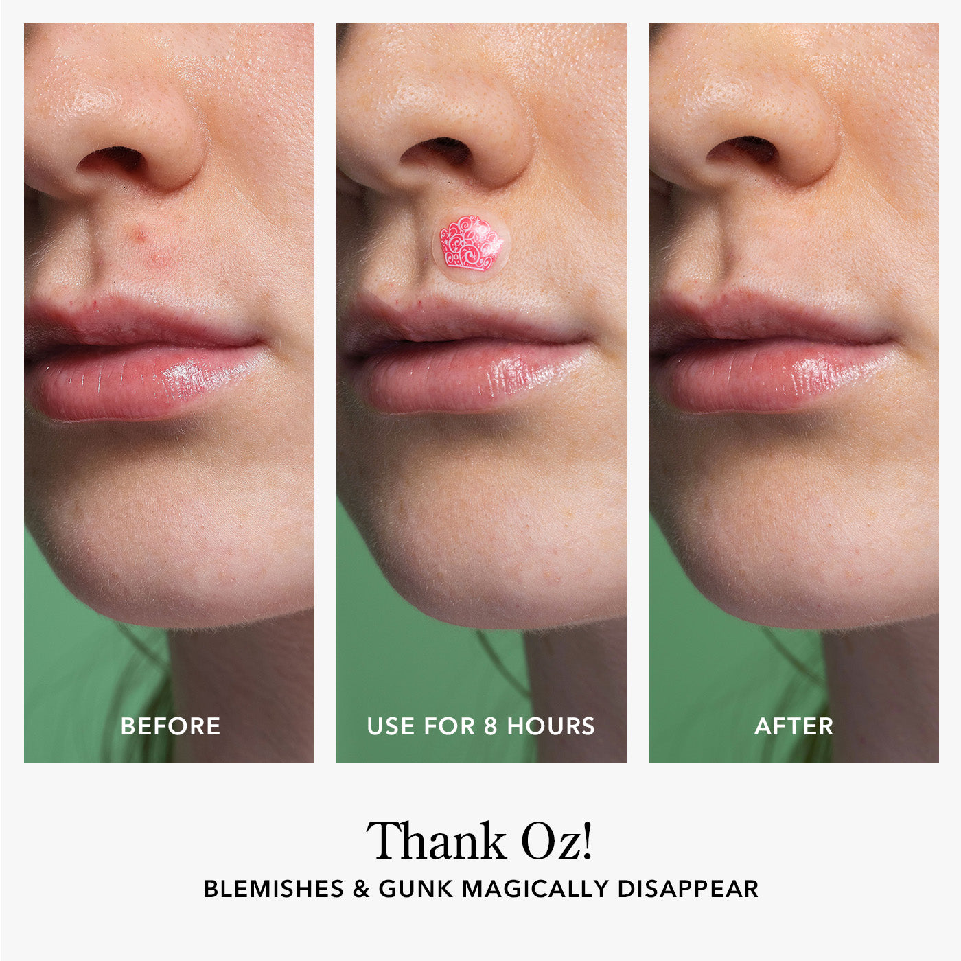 Beekman 1802 x Wicked Thank Oz! Blemish Patches - Acne Spot Treatment for Clear Skin | Perfect for Travel & Daily Skincare Routine