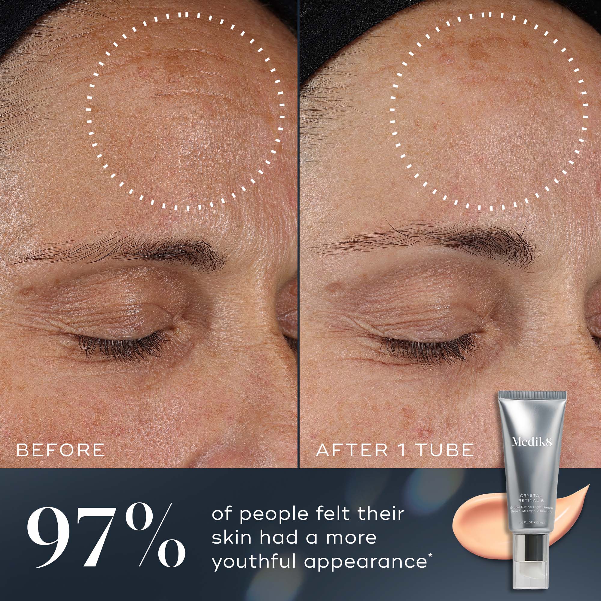 Professional Crystal Retinal Serum for Anti-Aging & Skin Rejuvenation | Vitamin A Skincare Treatment for Fine Lines & Wrinkles | Perfect for Nighttime Routine & Dermatologist Recommended