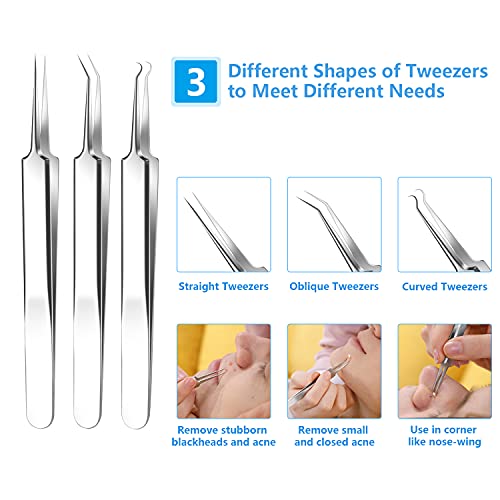 2024 Professional Blackhead Remover Kit - 20PCS Stainless Steel Comedone Extractor Tools for Acne, Pimples & Whitehead Removal - Dermatologist-Recommended Blackhead Extractor Set for Face & Body Care - Perfect for Home Spa & Skincare Routine