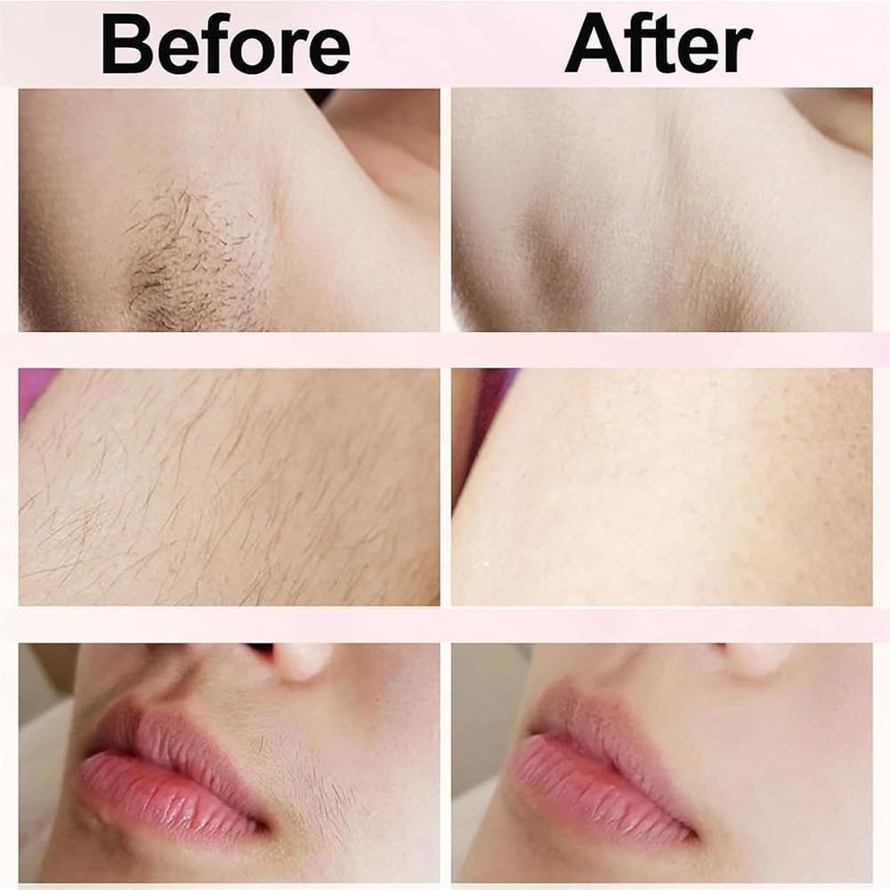Upgraded Smoovi 2.0 Bikini Shaver - 2-in-1 Electric Razor for Legs & Bikini Area, Waterproof for Wet/Dry Use - Perfect for Travel & Smooth Skin Care