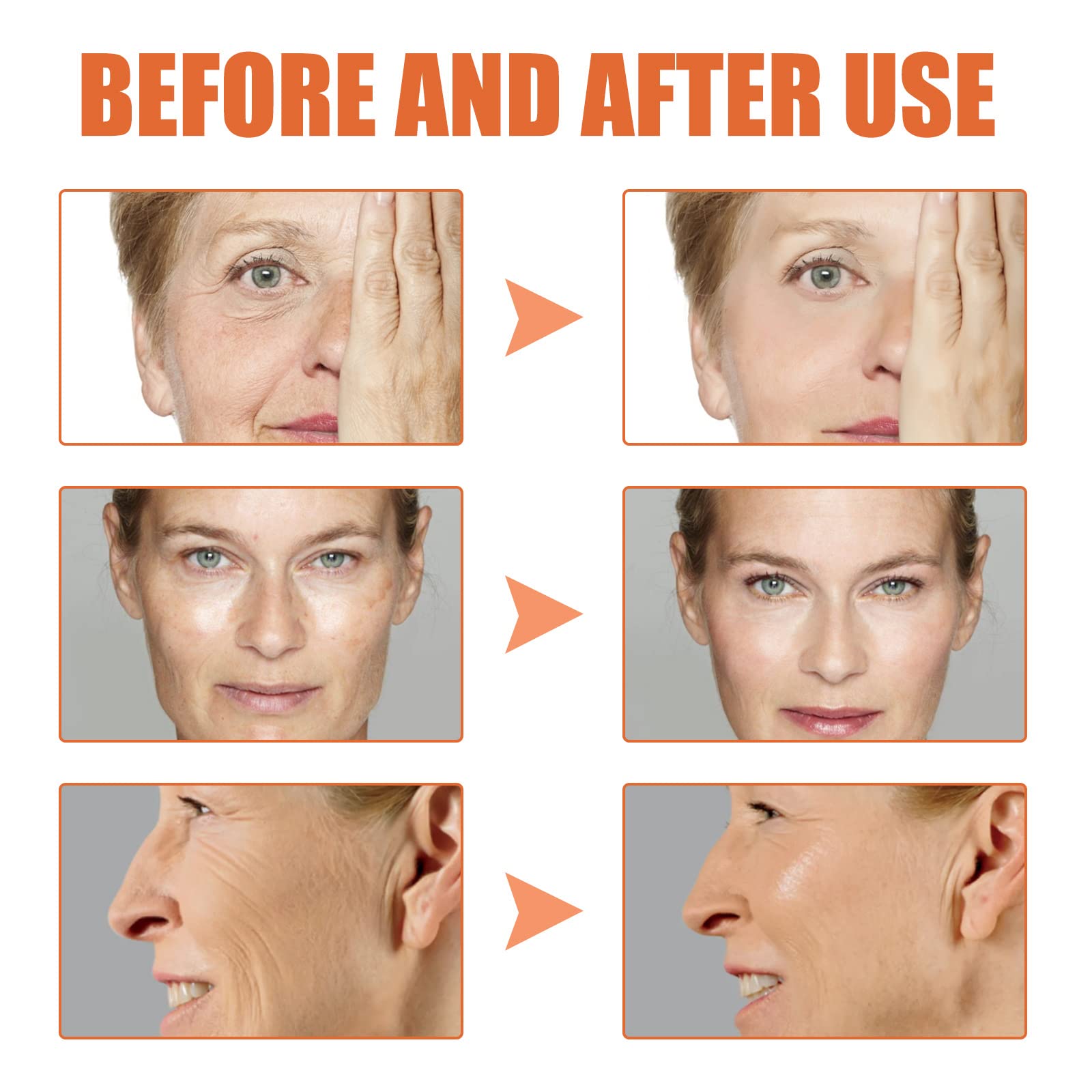 Powerful Anti-Aging Serum for Dark Spots & Wrinkles - Advanced Skin Brightening Treatment with Deep Hydration, Reduces Fine Lines (3 Pack) - Perfect for Night Routine & Daily Skincare Regimen