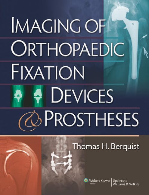 Orthopedic Fixation Devices & Prostheses Imaging for Surgery Planning