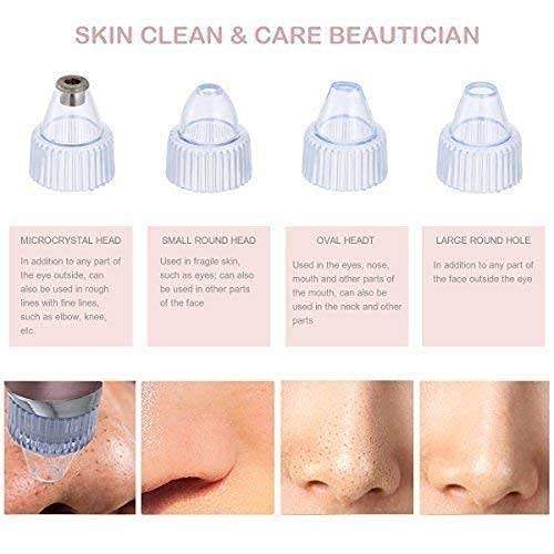 VAVSU 4-in-1 Electric Blackhead Remover & Pore Vacuum Cleaner | Professional Acne Pimple Extractor Tool for Face & Nose | Rechargeable Facial Skin Care Device for Deep Cleansing & Spa Treatment at Home