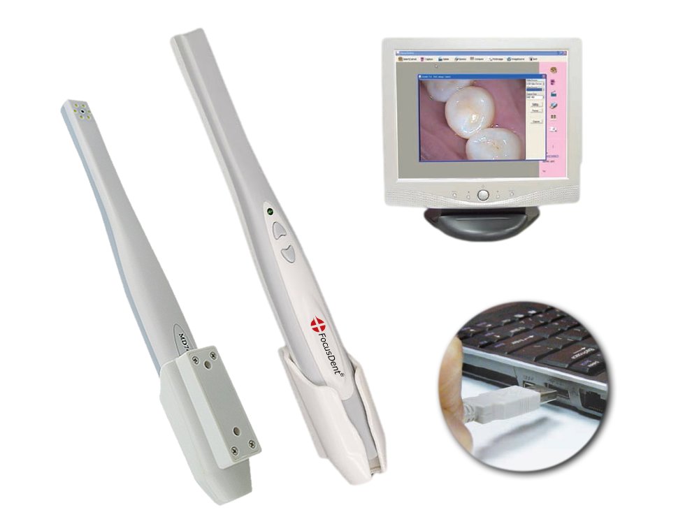 MD740 Dental Intraoral Camera with USB Connection - 6 LED Lights & 1.3MP HD Imaging - Includes Dental Software for Oral Examinations & Patient Education