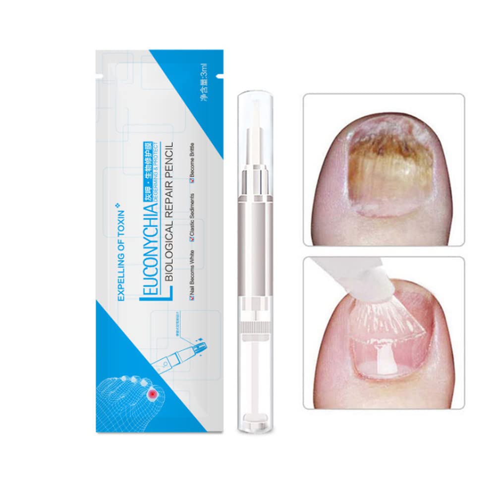 Allbestaye Fungal Nail Repair Pen - Effective Treatment for Onychomycosis & Paronychia, Restores Healthy Nails Damaged by Fungus | Anti-Fungal Nail Infection Solution for Toenails & Fingernails | Perfect for Daily Nail Care & Salon Use
