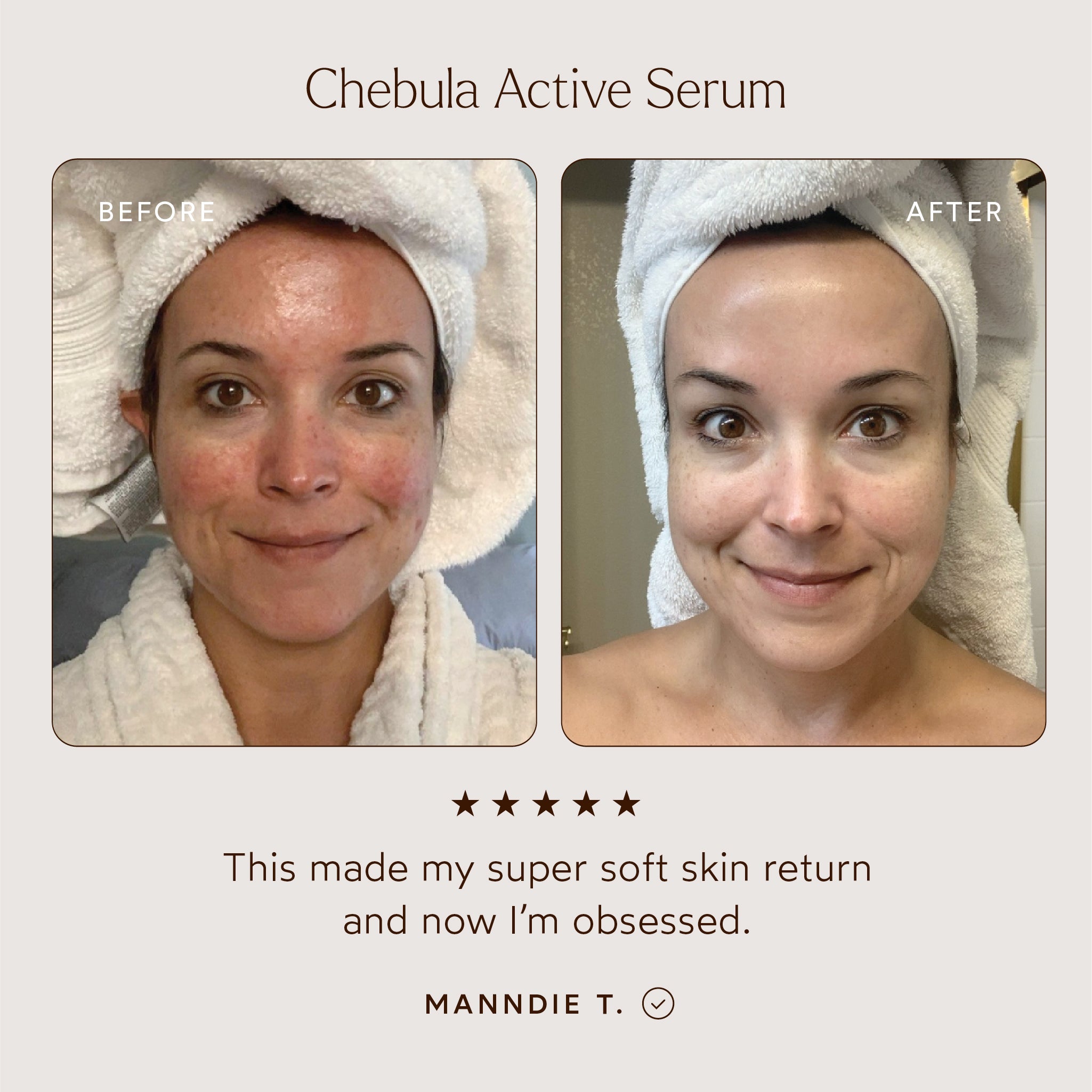 Chebula Active Anti-Aging Serum for Face - Organic Wrinkle Treatment & Skin Tightening Cream - Best for Night Routine, Dry Skin Care & Mature Skin Rejuvenation