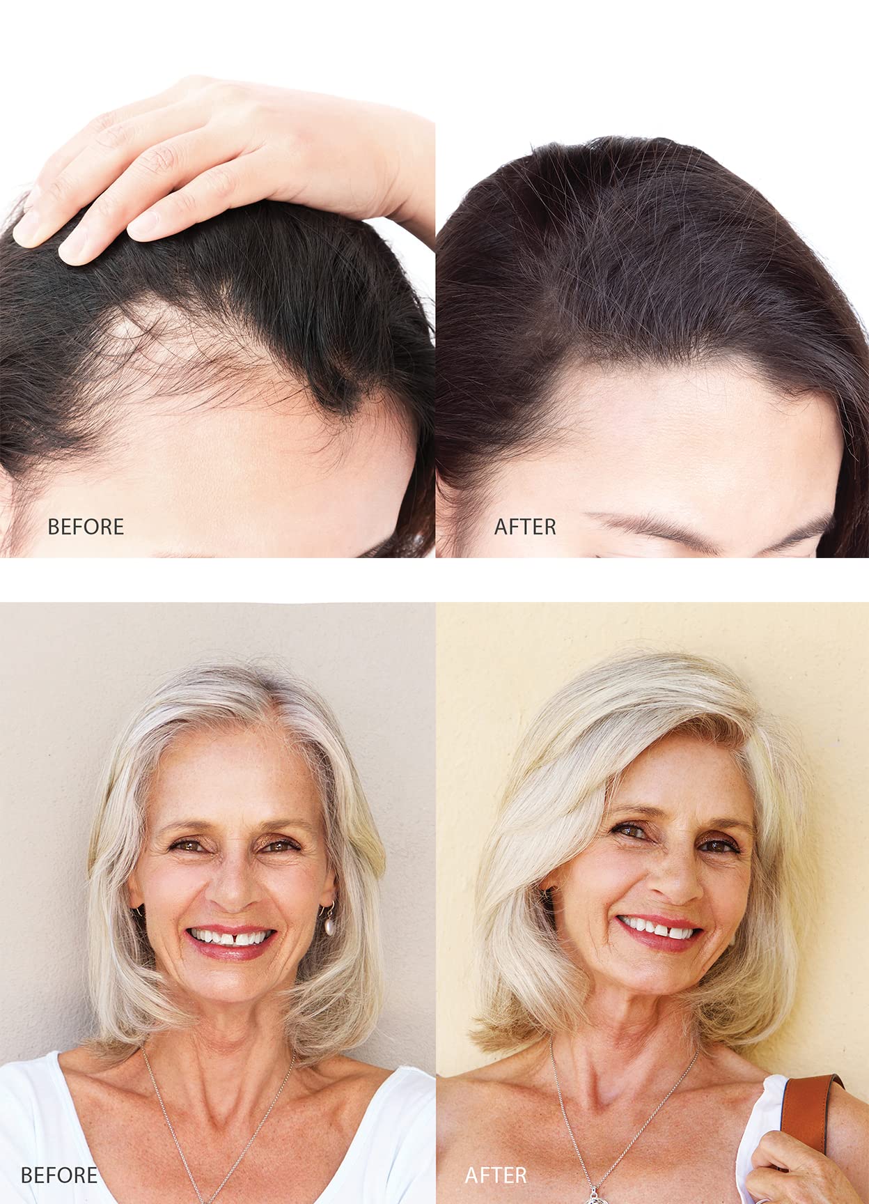 Lifespan Hair Restorer for Men & Women - Natural Hair Growth Treatment for Thinning Hair & Baldness - Best Hair Regrowth Serum for Daily Use at Home & Salon