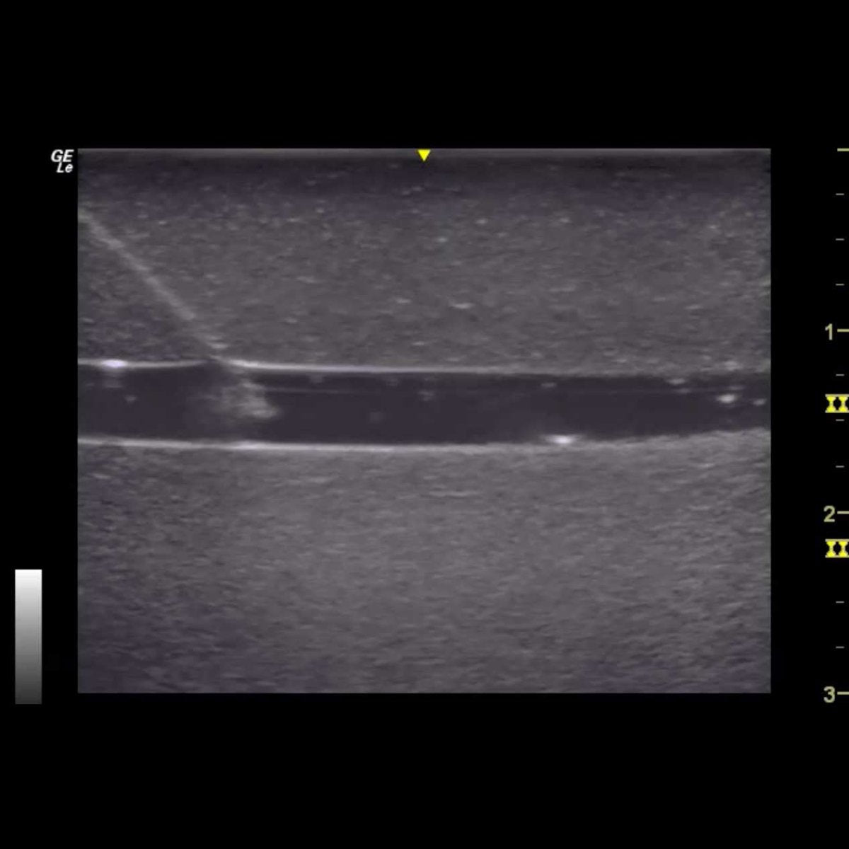 HM4.0 Reusable 4-Vessel Ultrasound Training Model - Perfect for Medical Students, Sonographers & Vascular Practice (Ideal for Carotid, Femoral & Venous Ultrasound Training)