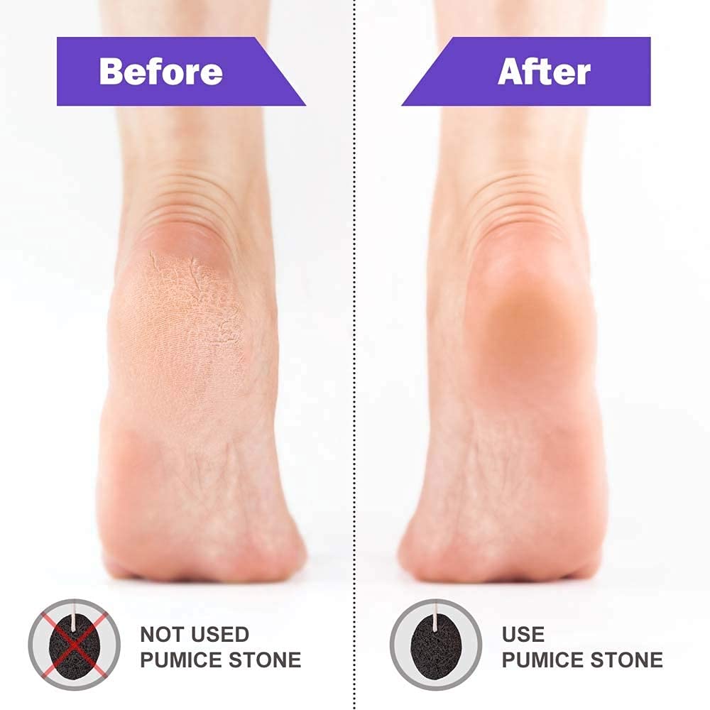 Natural Pumice Stone for Feet - Exfoliating Dead Skin, Callus & Cracked Heels - Men & Women Pedicure Tool - Small Size for Travel & Home Use - Perfect for Spa Day & Foot Care Routine