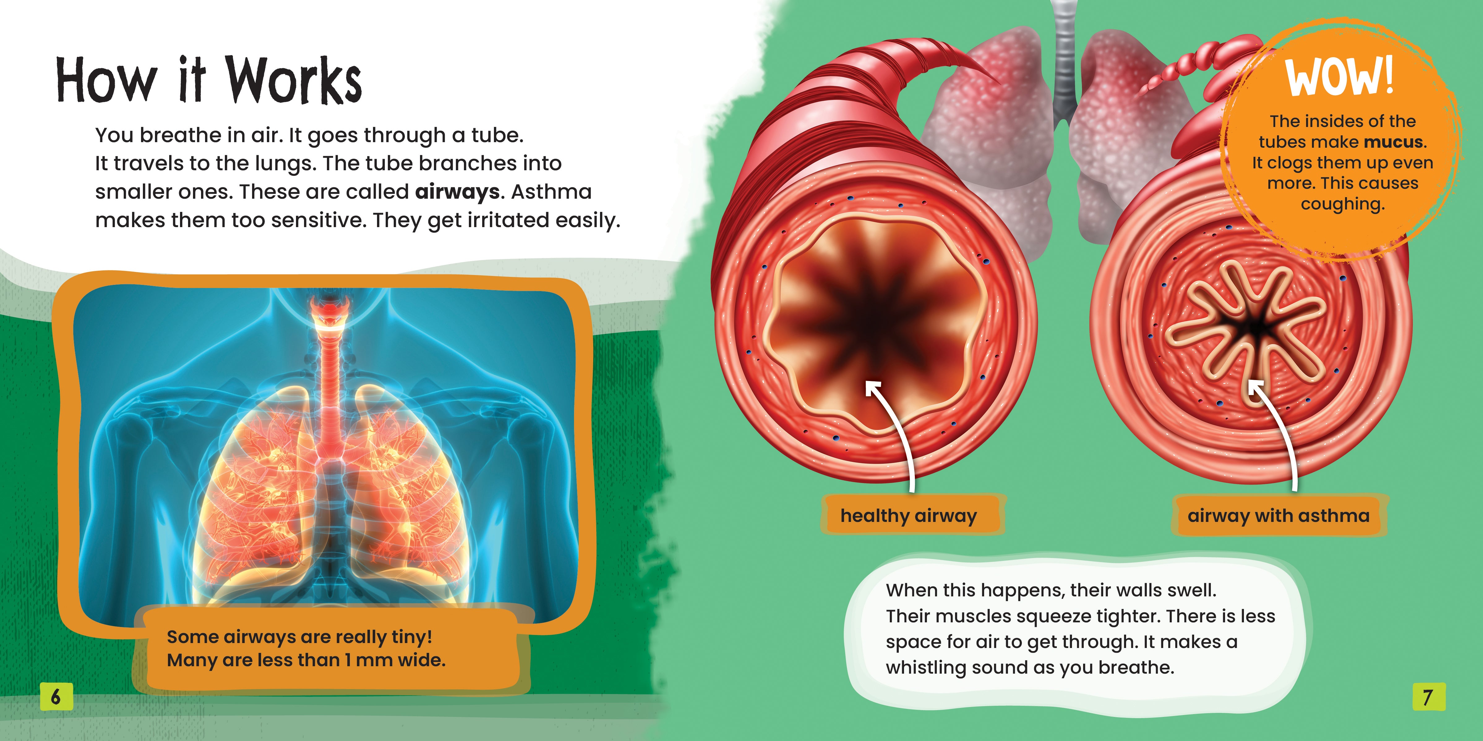 Asthma Fast Track: Effective Living Solutions for Asthma Management - Perfect for Home, Work & Outdoor Activities