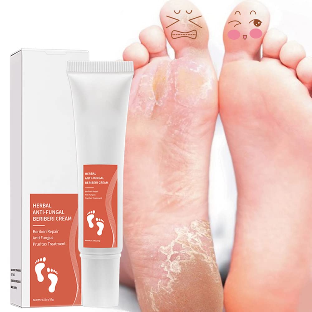 Allbesta Herbal Anti-Fungal Foot Cream - Treats Foot Infections, Reduces Inflammation & Relieves Itching - Effective for Athlete's Foot, Ringworm & Nail Fungus - Perfect for Daily Foot Care & Post-Workout Recovery