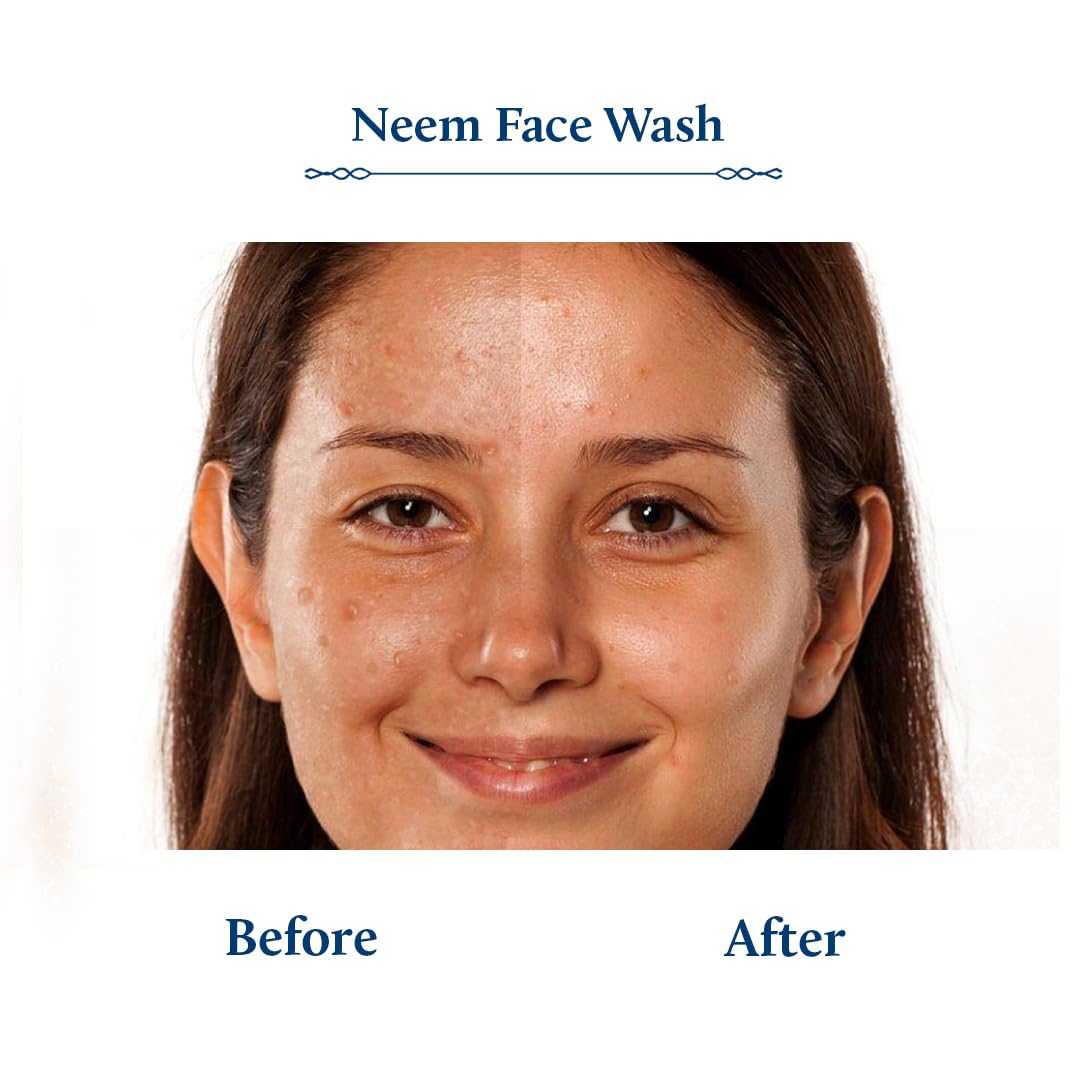 Blue Nectar Vitamin C Face Wash - Neem & Honey for Acne - Ayurvedic Skincare for Daily Use