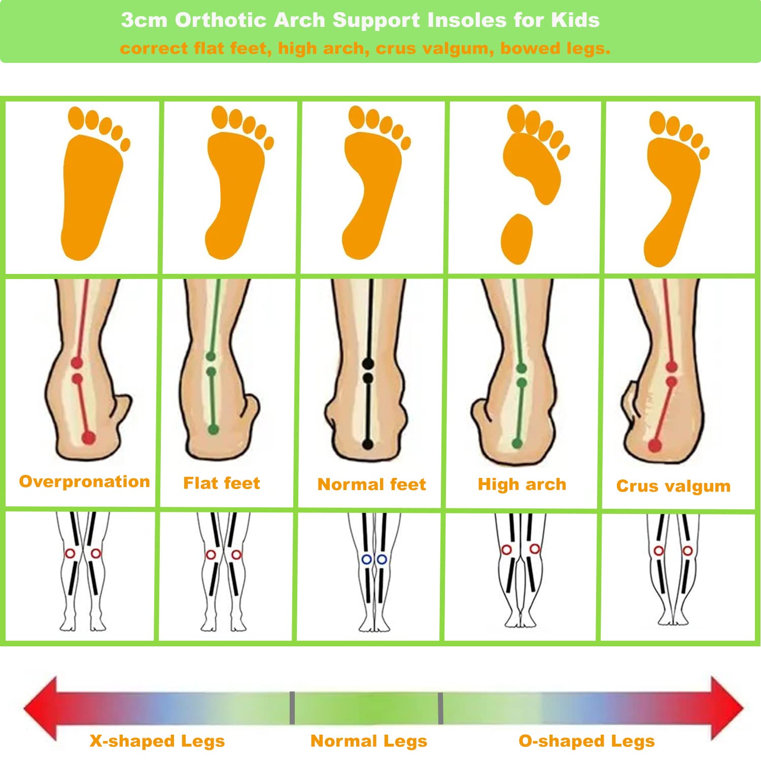 **Orthotic Shoe Insoles for Kids – Arch Support Inserts for Flat Feet, PU Cushion Sole Replacement – Ideal for Active Boys, Sports & School Comfort**