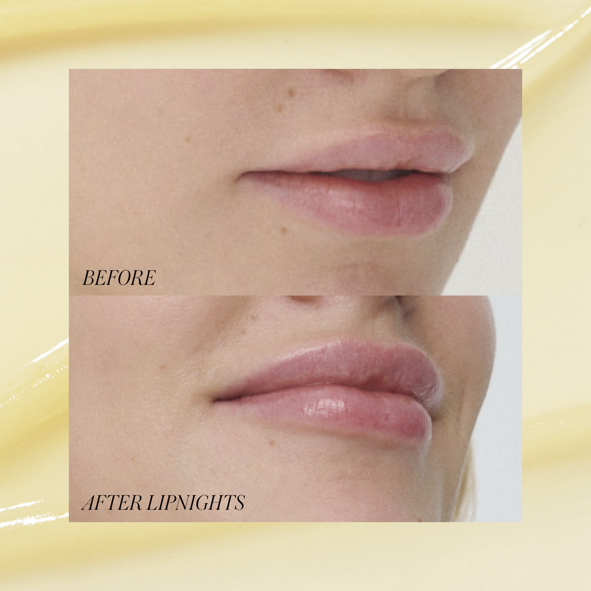 Lipnights Sleepover Lip Mask - Overnight Hydrating Lip Treatment for Dry, Chapped Lips | Perfect for Nighttime Skincare Routine & Travel Essentials