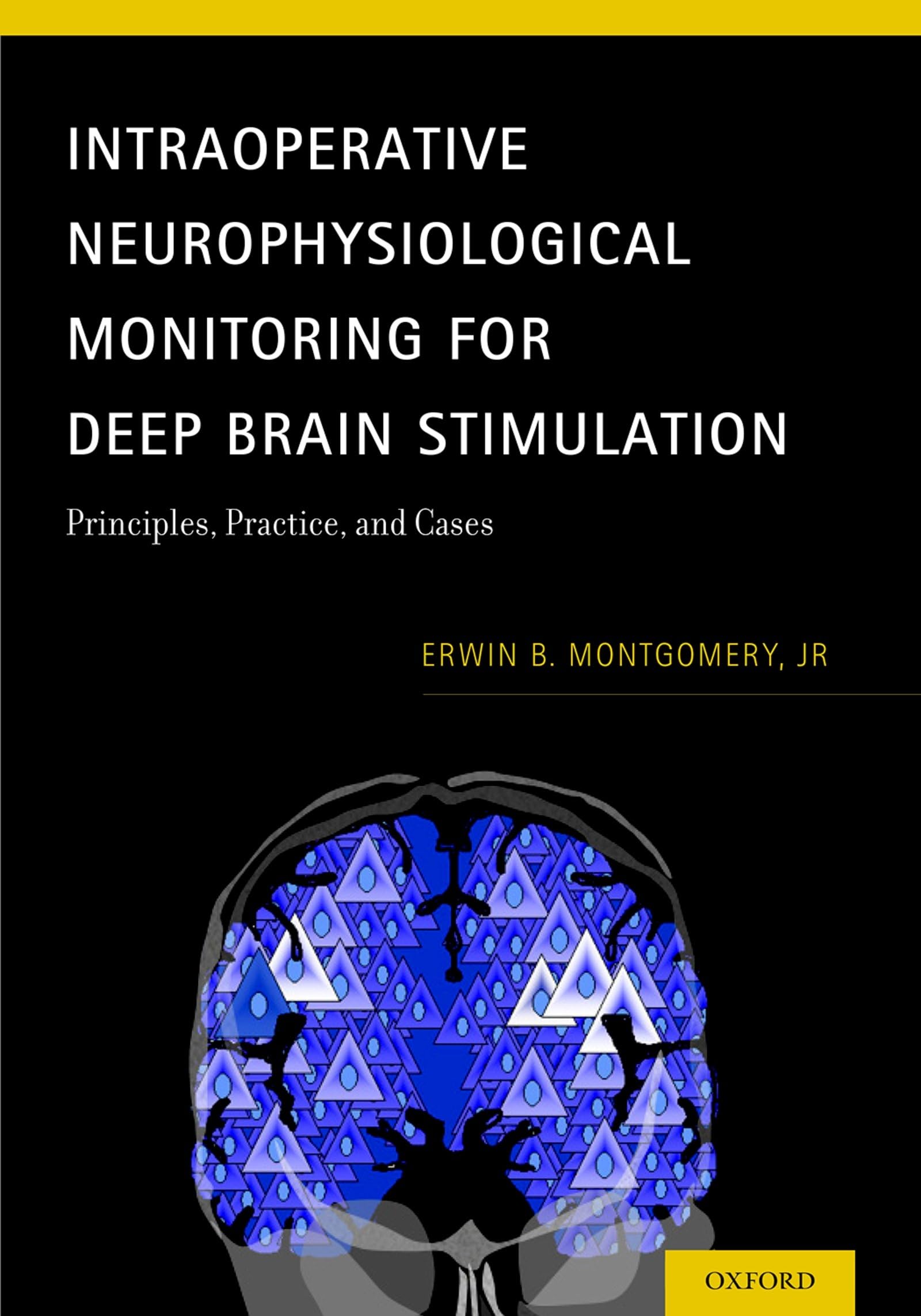 Intraoperative Neurophysiological Monitoring for Deep Brain Stimulation: Principles, Practice & Case Studies | Surgical Neurology & Neurosurgery Applications