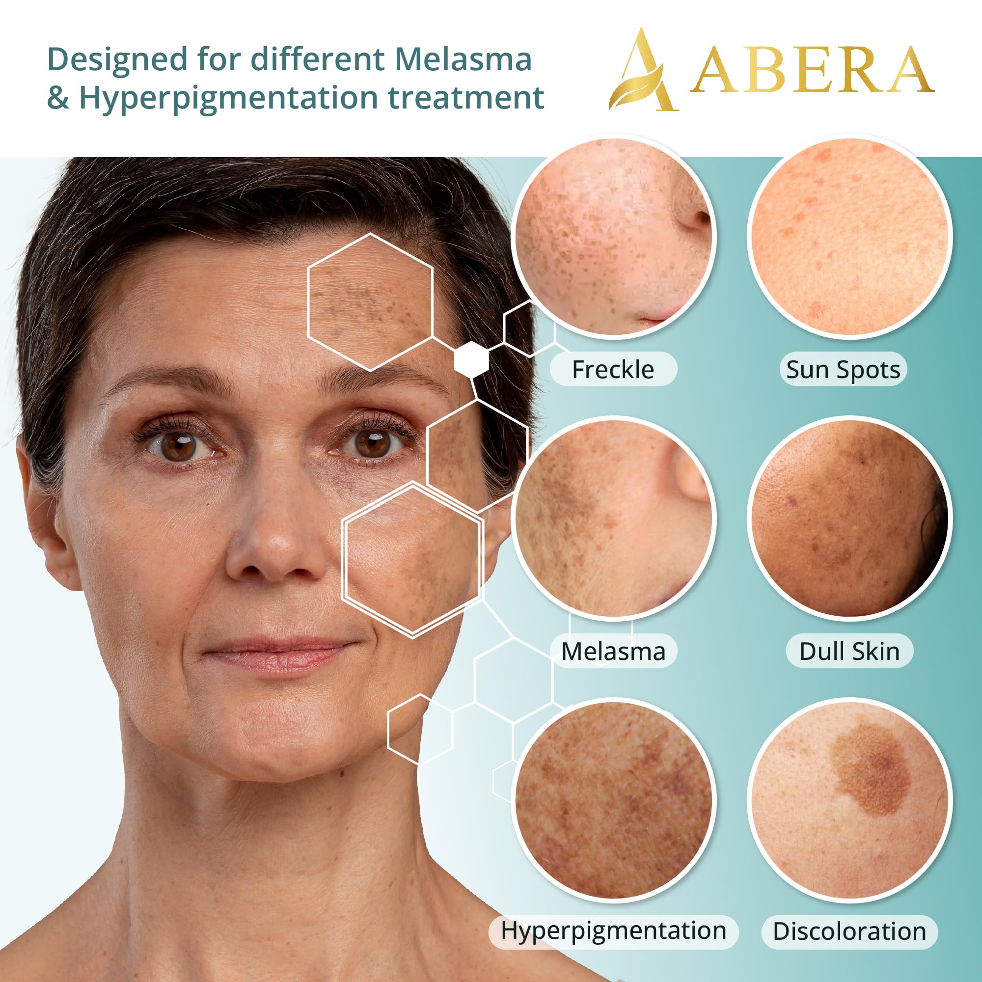 Abera Melasma Serum Plus - Advanced Dark Spot Corrector for Face | Sun Spot, Age Spot & Brown Spot Treatment for Men & Women (1 FL OZ) | Brightens Skin Tone & Reduces Hyperpigmentation | Ideal for Daily Skincare Routine & Post-Sun Care