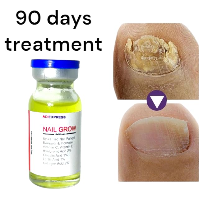 Nail Strengthening Gel Oil - Nourishing & Brightening Treatment for Strong, Smooth, Healthy Nails | Promotes Healthy Nail Growth | Ideal for Nail Fungus Prevention & At-Home Manicures