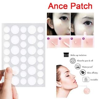 SSM Mart Hydrocolloid Acne Pimple Patches for Face - Spot Treatment Stickers for Blemishes & Breakouts | Calms & Relieves Acne Fast | Perfect for Overnight Use, Travel & Daily Skincare Routine