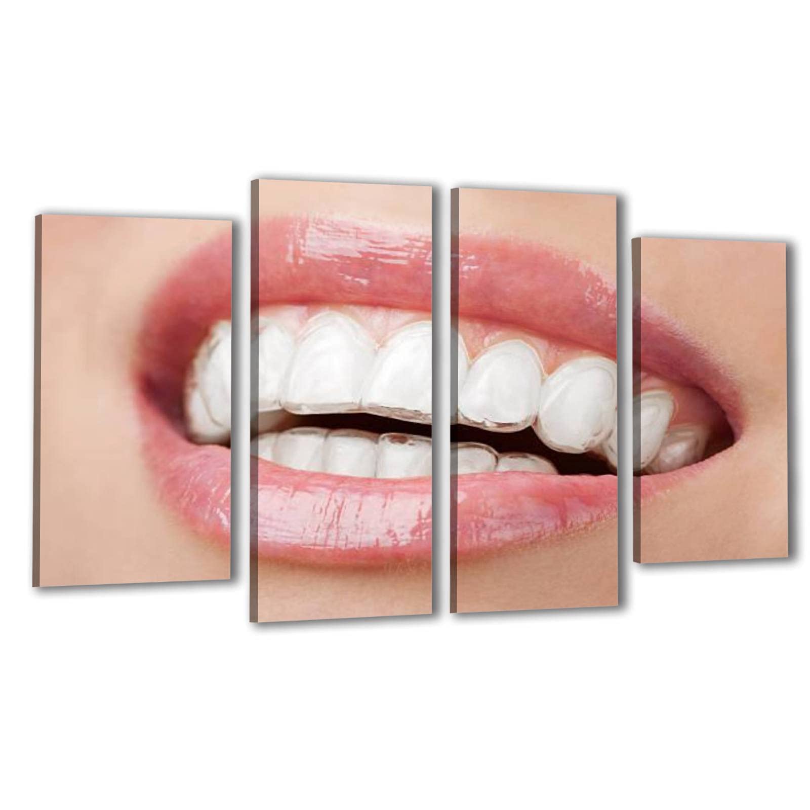 Teeth Whitening Tray Smiling Mouth Wall Art Canvas - Modern Framed Prints for Bedroom & Living Room Decor - Ready to Hang Home Decoration Gift Set of 4 - Perfect for Dental Offices, Bathrooms & Spa Spaces