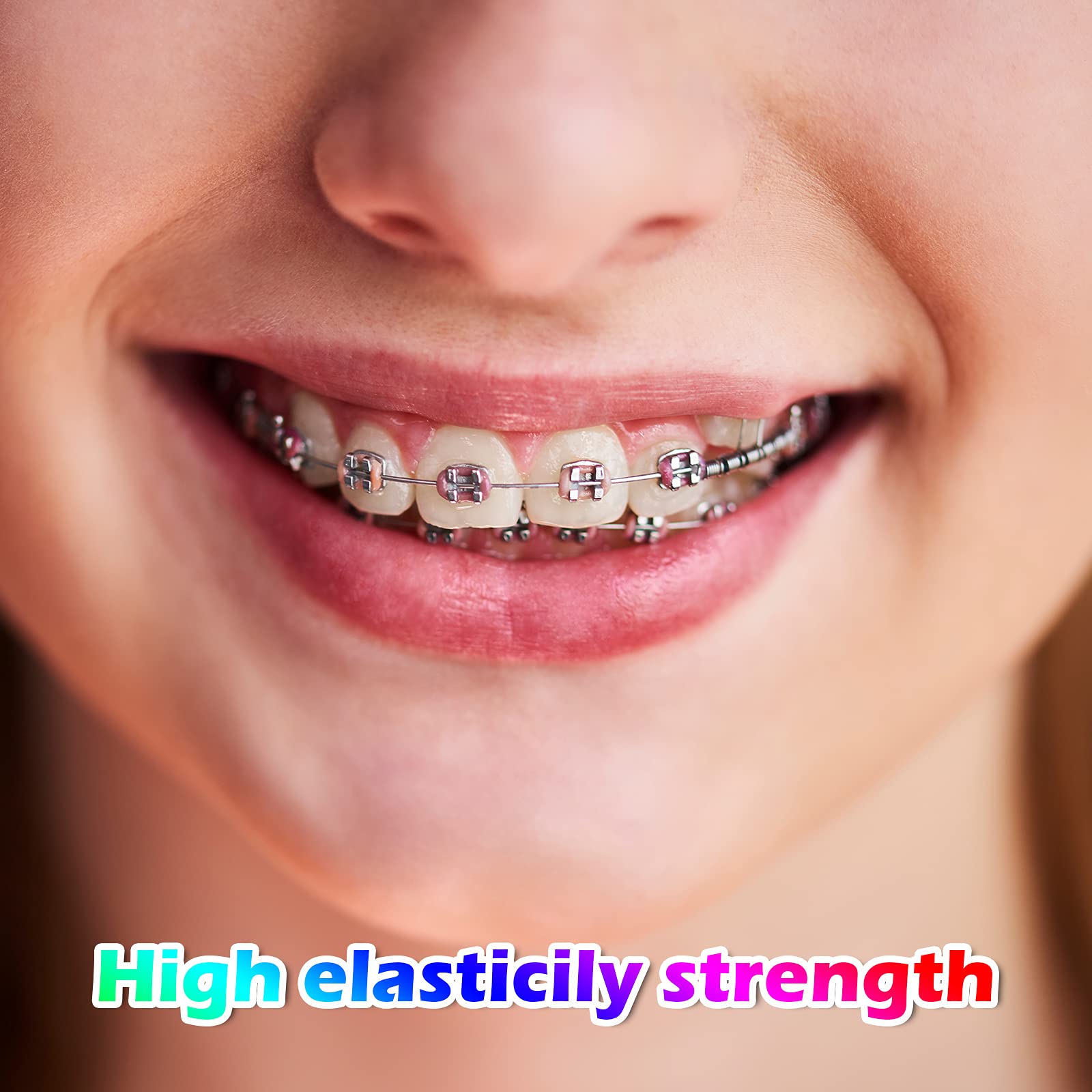 Colorful Nuanchu 2080 O-Rings Orthodontic Elastic Ligature Ties - Latex-Free Rubber Bands for Braces (Multicolor Pack) - Perfect for Orthodontic Treatment & Teeth Alignment