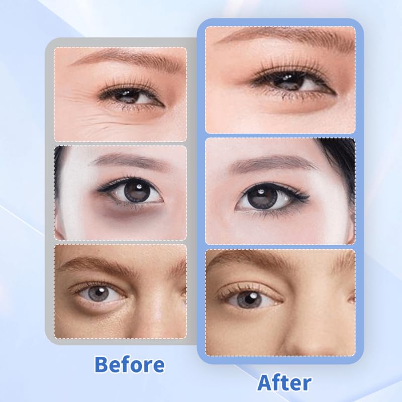 Collagen Under Eye Patches for Wrinkles & Dark Circles - Self-Dissolving Eye Mask to Tighten Skin & Reduce Puffiness - Invisible Eye Film for Women | Perfect for Night Routine & Travel Skincare