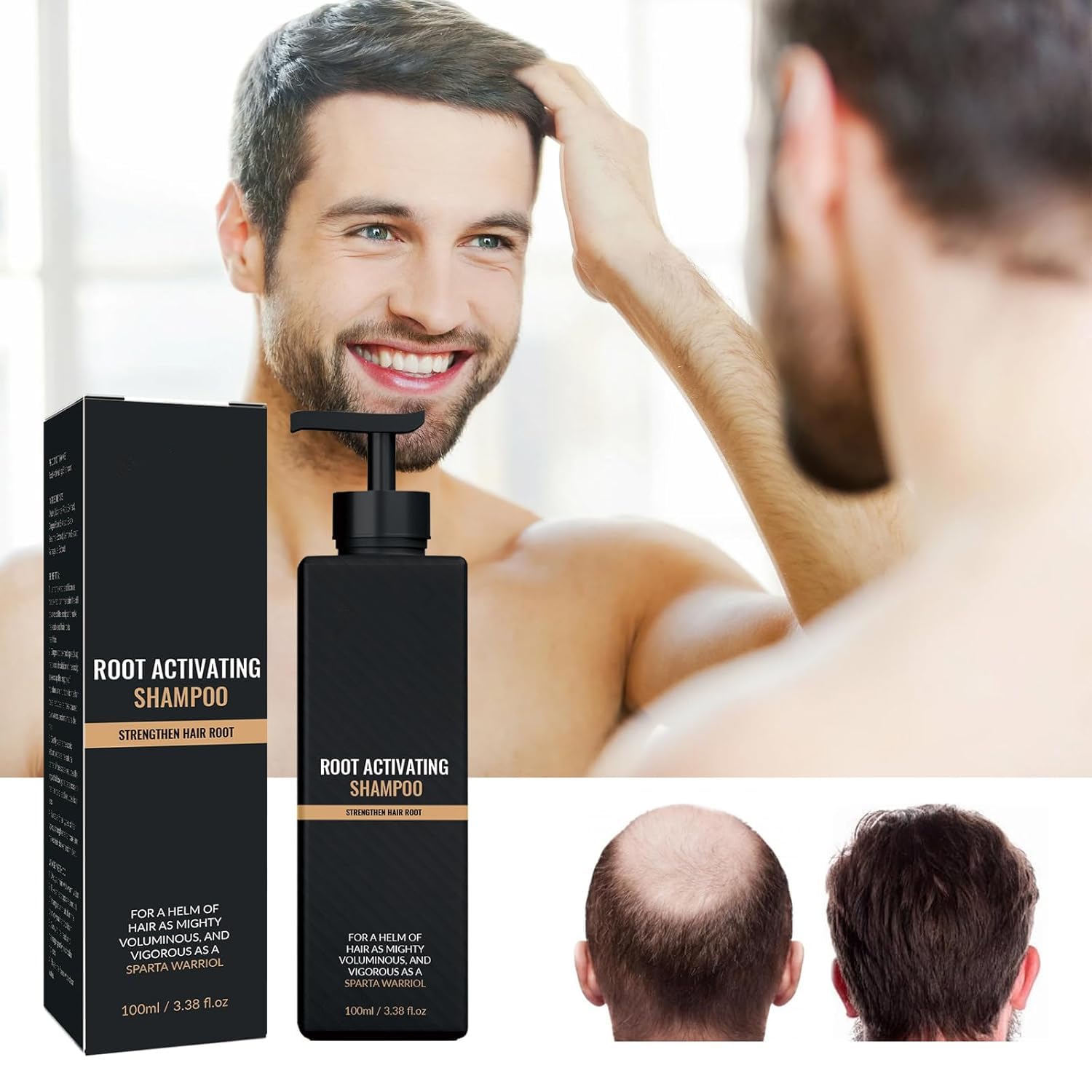 Spartan Root Activator Shampoo for Hair Regrowth - Natural Shampoo for Men & Women - 2 x 100ml Bottles - Promotes Thicker Hair & Reduces Hair Loss - Perfect for Daily Use & Scalp Care