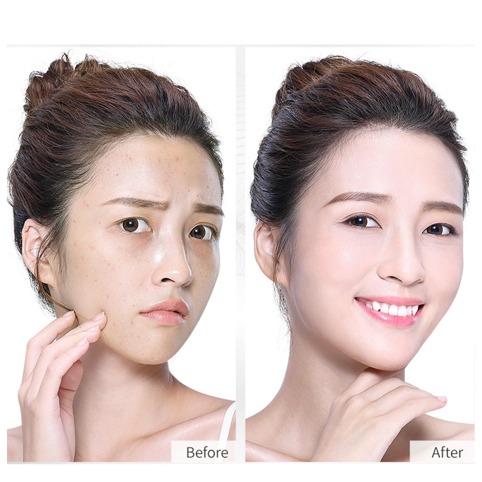 BONDIJ Instalift Protein Thread Lifting Set - 3pcs Absorbable Collagen Threads for Face Lift, Invisible Facial Threads, Wrinkle Reduction & Skin Tightening | Perfect for Anti-Aging, Facial Rejuvenation & At-Home Beauty Treatments