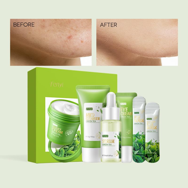 Green Tea Skincare Set - 19-in-1 Natural Skincare Gift Set with Cleanser, Serum, Cream, Eye Cream & Masks | Moisturizing Facial Care Kit for Teen Girls | Perfect for Daily Routine & Spa Night