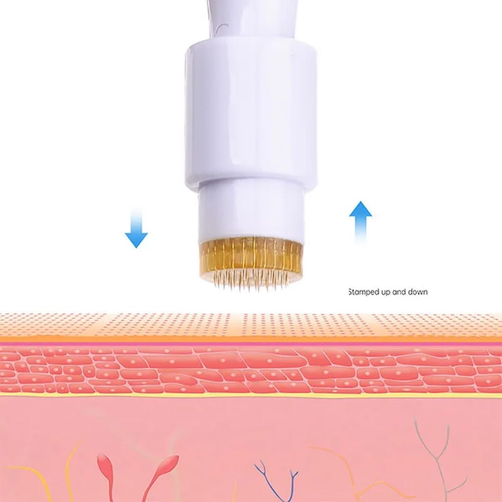 Myora 1.5mm Titanium Derma Roller for Face & Scalp – Professional Microneedling Stamp for Anti-Aging, Acne Scars, Pore Minimization & Hair Growth – At-Home Skin Care Treatment for Women & Men – Perfect for DIY Facial Rejuvenation & Beard Enhancement