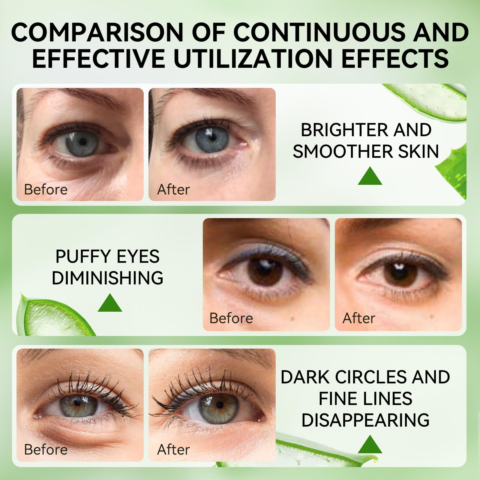 LANBENA Aloe Vera Under Eye Patches for Puffy Eyes and Dark Circles - Collagen Eye Gel Mask for Hydration & Skin Elasticity - Perfect for Morning Skincare & Travel Essentials