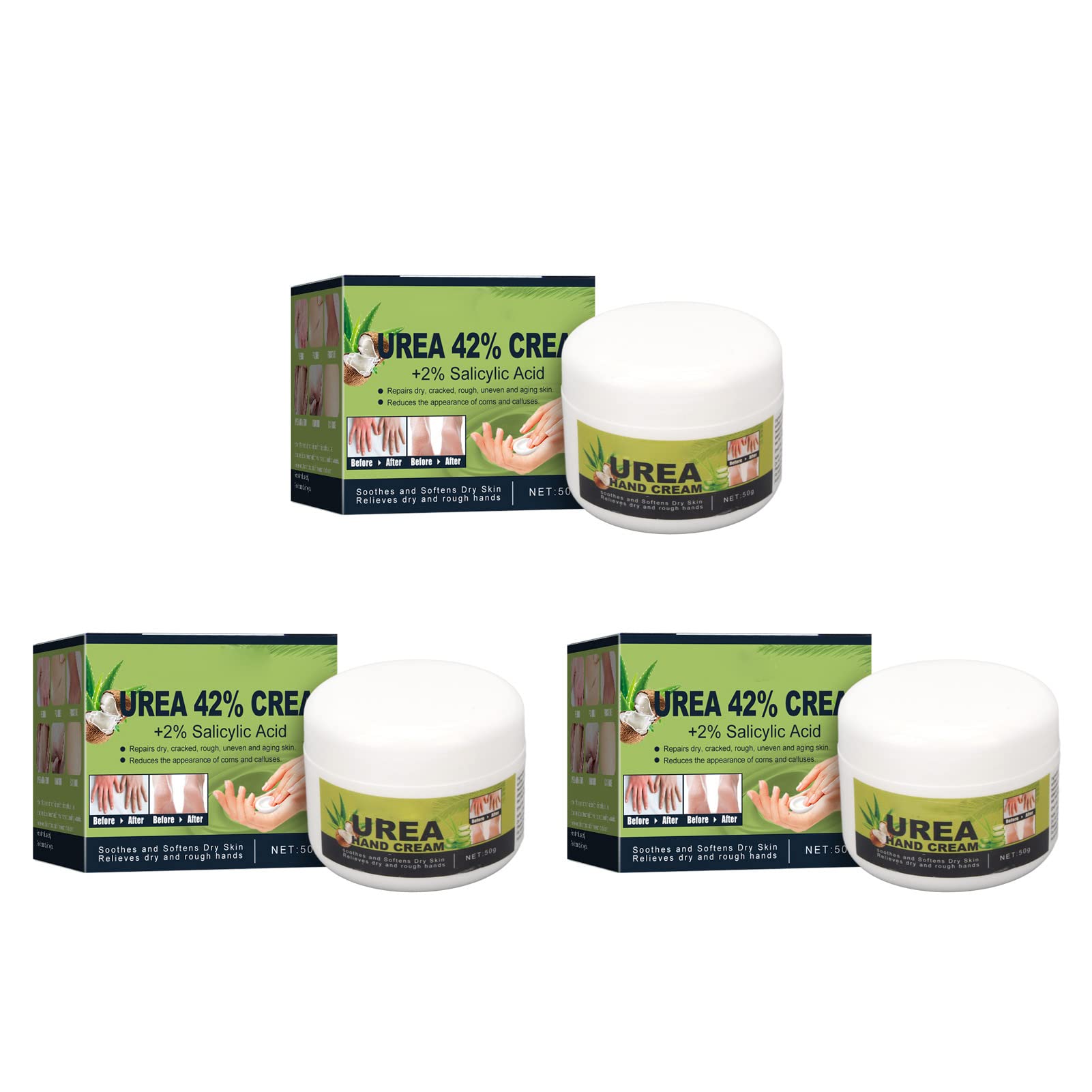 Moisturizing Hand Foot Cream for Dry Itchy Skin - Repair & Soften