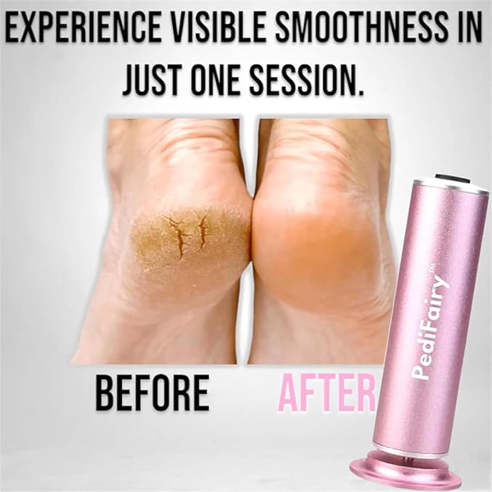 Dermave Electric Foot Callus Remover & Pedicure Polisher - 360° Rotating Exfoliator for Smooth Feet - Professional Foot Grinder for Dead Skin & Callus Removal (Black) - Perfect for Home Spa & Pedicure Care