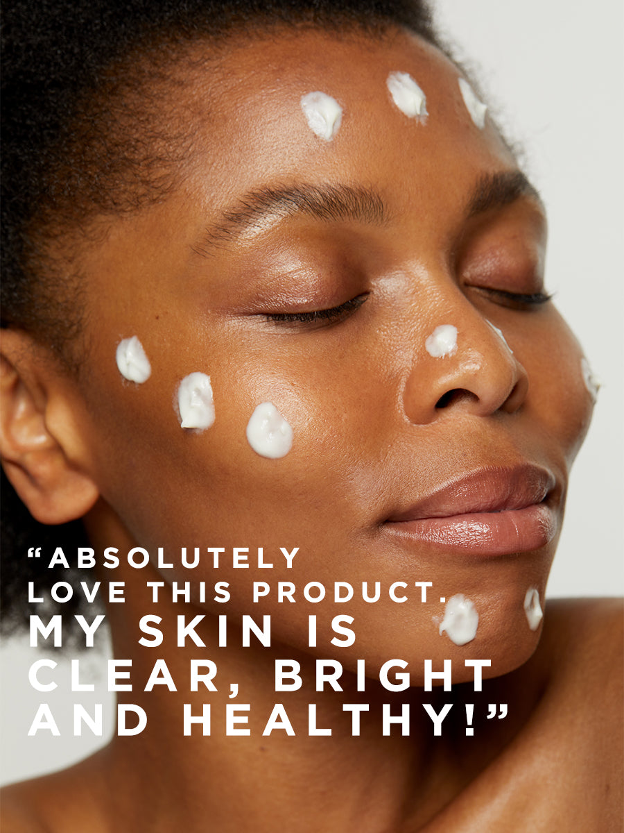 Flawless Brightly 10% Azelaic Acid Serum for Acne & Rosacea - Skin Brightening & Blemish Treatment - Perfect for Daily Skincare Routine & Sensitive Skin Care