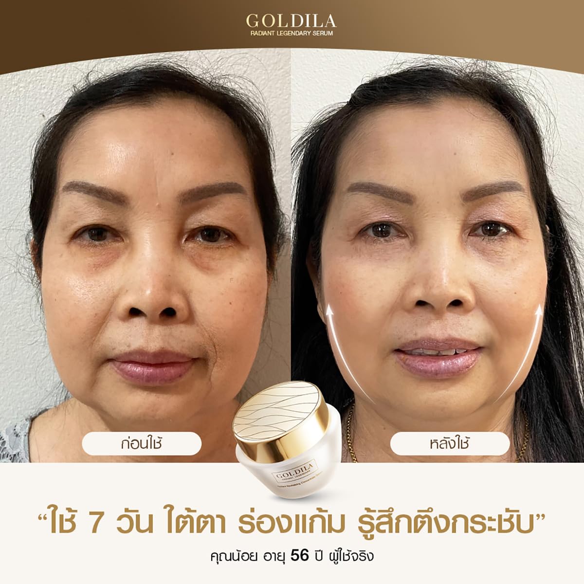 Goldila R R Concentrate Serum 30ml - French Anti-Aging Face Serum for Smooth & Moisturized Skin | 4-Pack Box | Perfect for Daily Skincare Routine & Gift Sets | Free Beauty Gifts Included