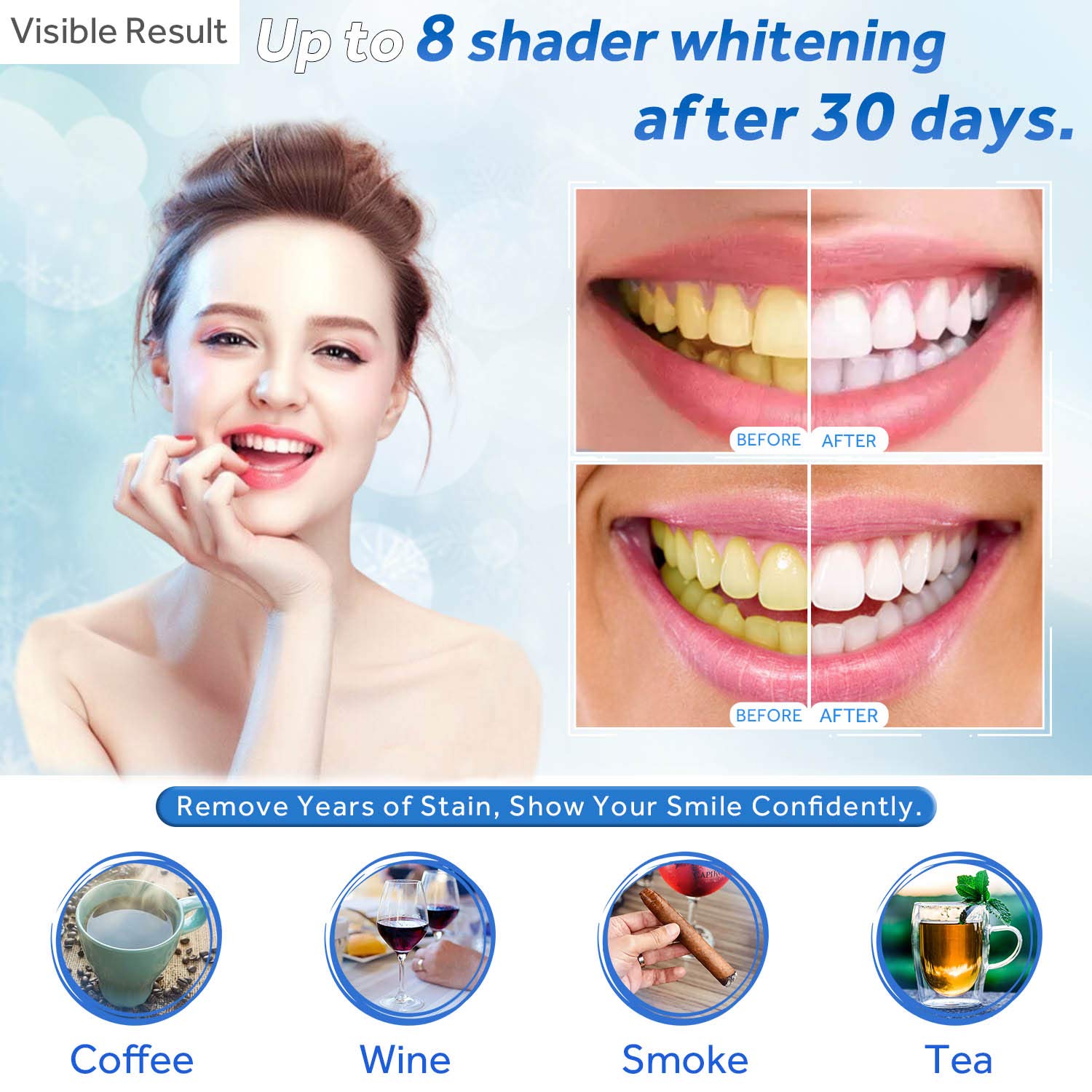 Professional EZGO Dental LED Teeth Whitening Kit with Blue Light Accelerator & 20-Piece C-Shape Cheek Retractors - At-Home Cold Bleaching for Brighter Smile, Perfect for Travel & Special Occasions