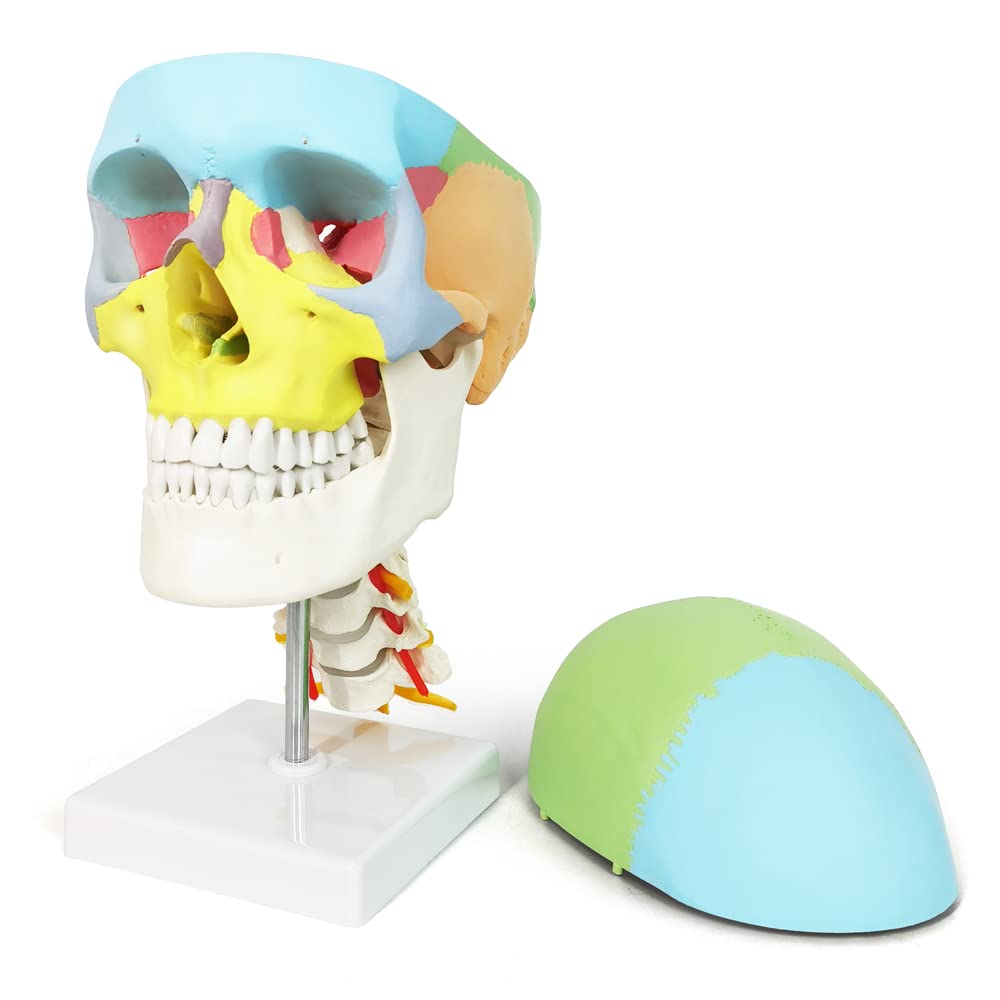 Human Anatomy Exploded Skull Model - Medical & Dental Teaching Tool for Students | Perfect for Classroom Demonstrations, Dental Clinics & Medical Education