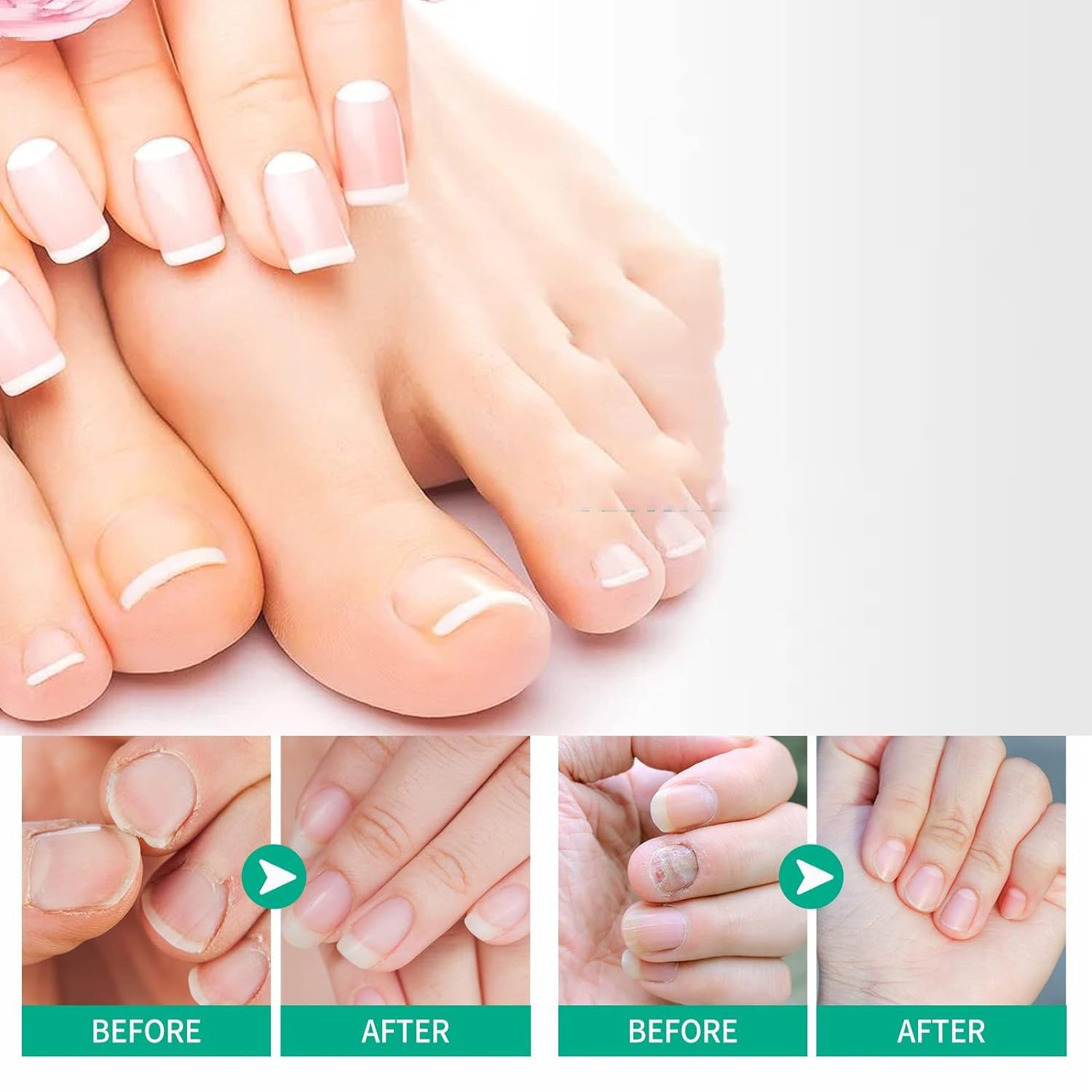 2PCS Herbal Nail Treatment Essence Kit - Oedo & Rosabelle Nail Strengthening Oil for Weak, Brittle & Damaged Nails - At-Home Nail Care Solution for Salon-Quality Results - Perfect for DIY Manicures & Nail Repair