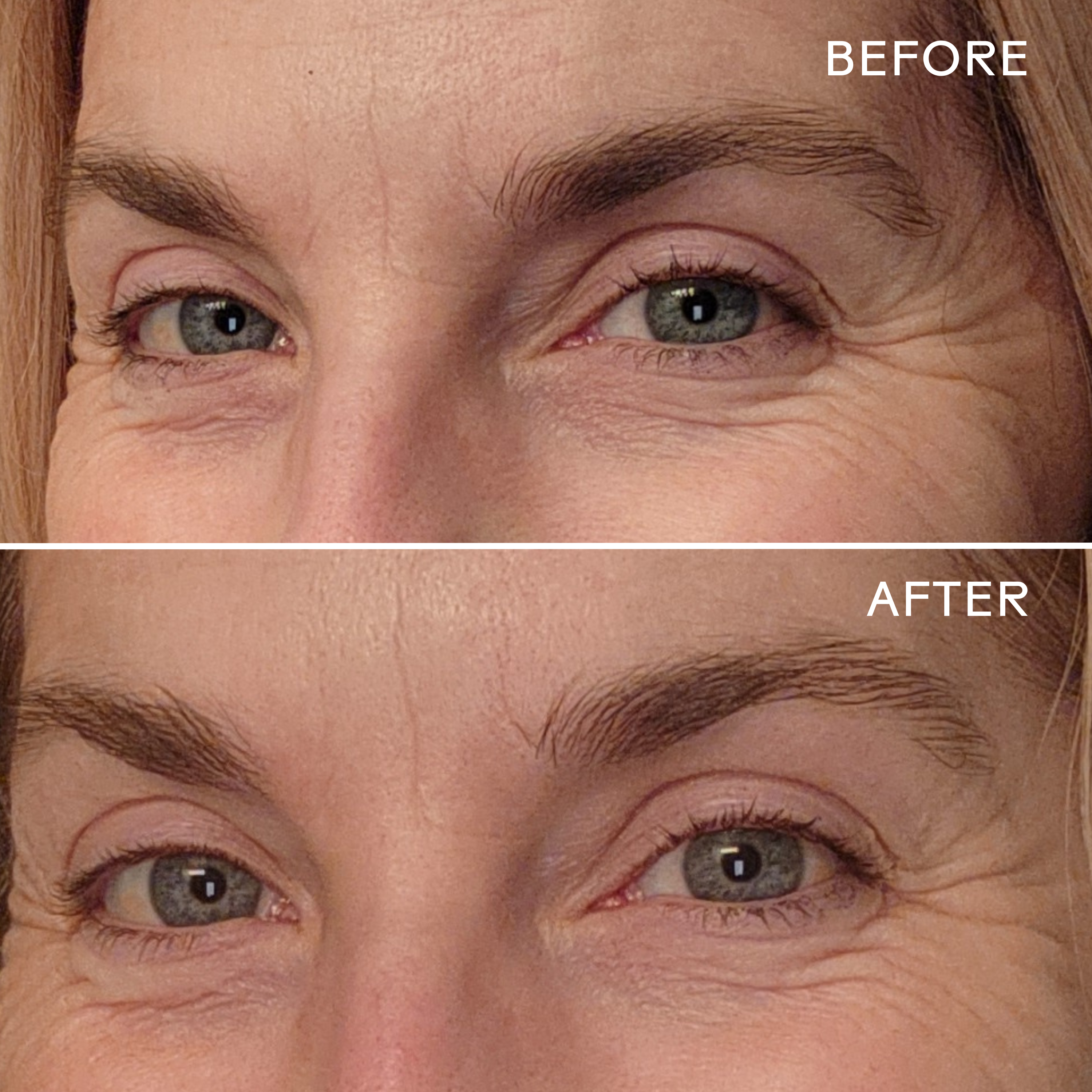 EyeHero™ Bio Retinol Smoothing Eye Cream - Anti-Aging & Wrinkle Reduction for Dark Circles & Puffiness - Perfect for Nighttime Skincare Routine & Travel