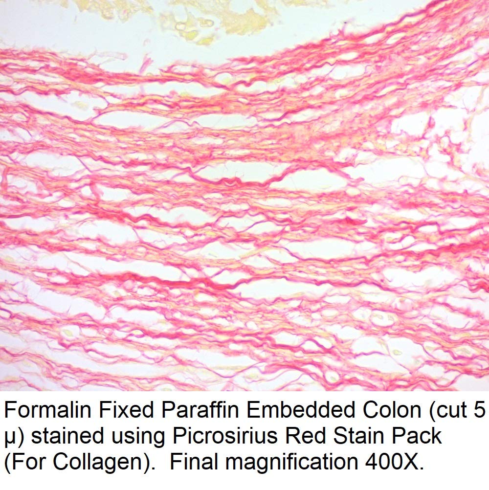 Picrosirius Red Stain Solution 1000ml - High-Quality Collagen Staining for Histology & Pathology Labs