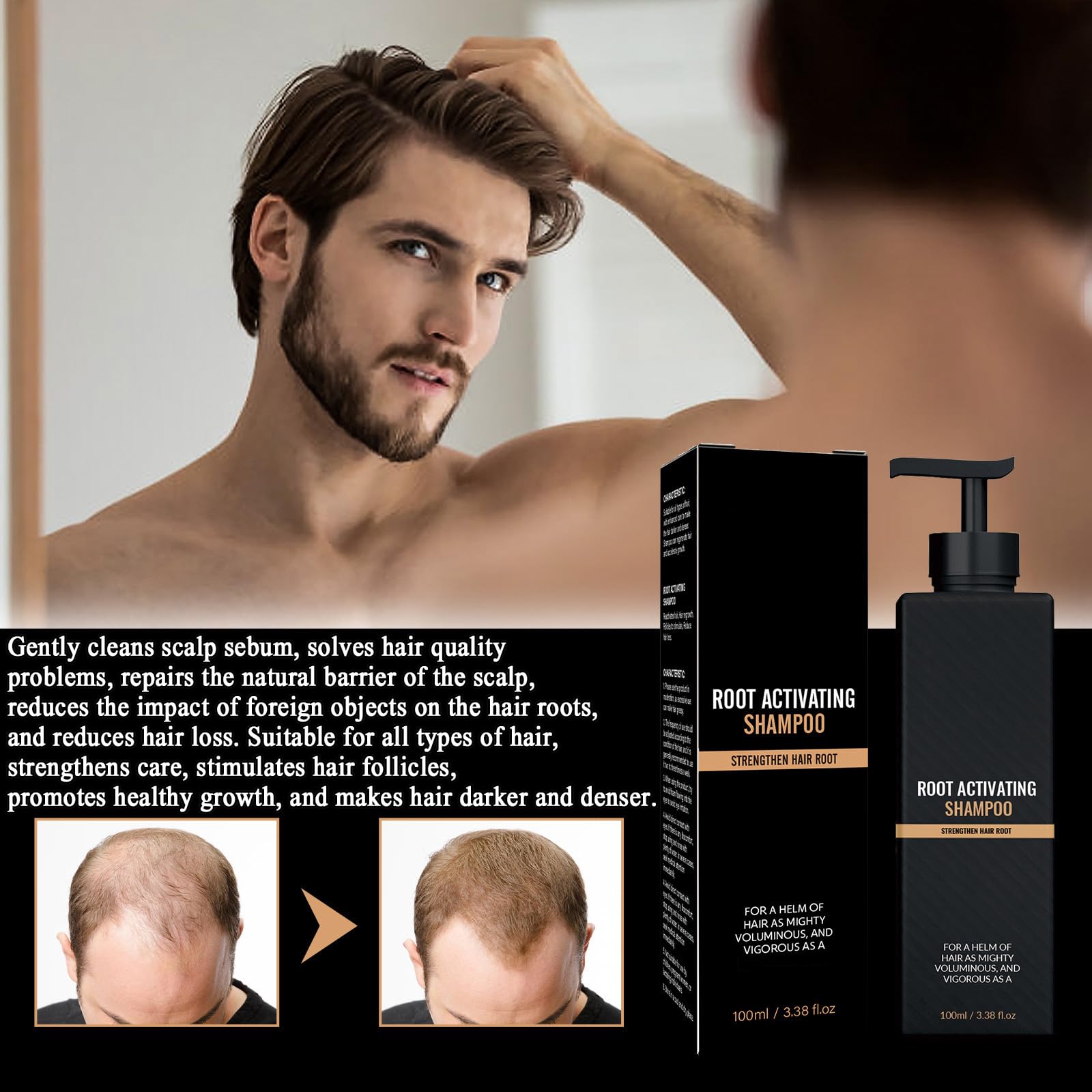 Root Activator Shampoo for Hair Growth & Thickening - Anti Hair Loss Treatment for Men & Women - Gray Hair Regrowth Conditioner - Strengthening Shampoo Soap (2 x 100ml) - Perfect for Daily Hair Care & Scalp Nourishment