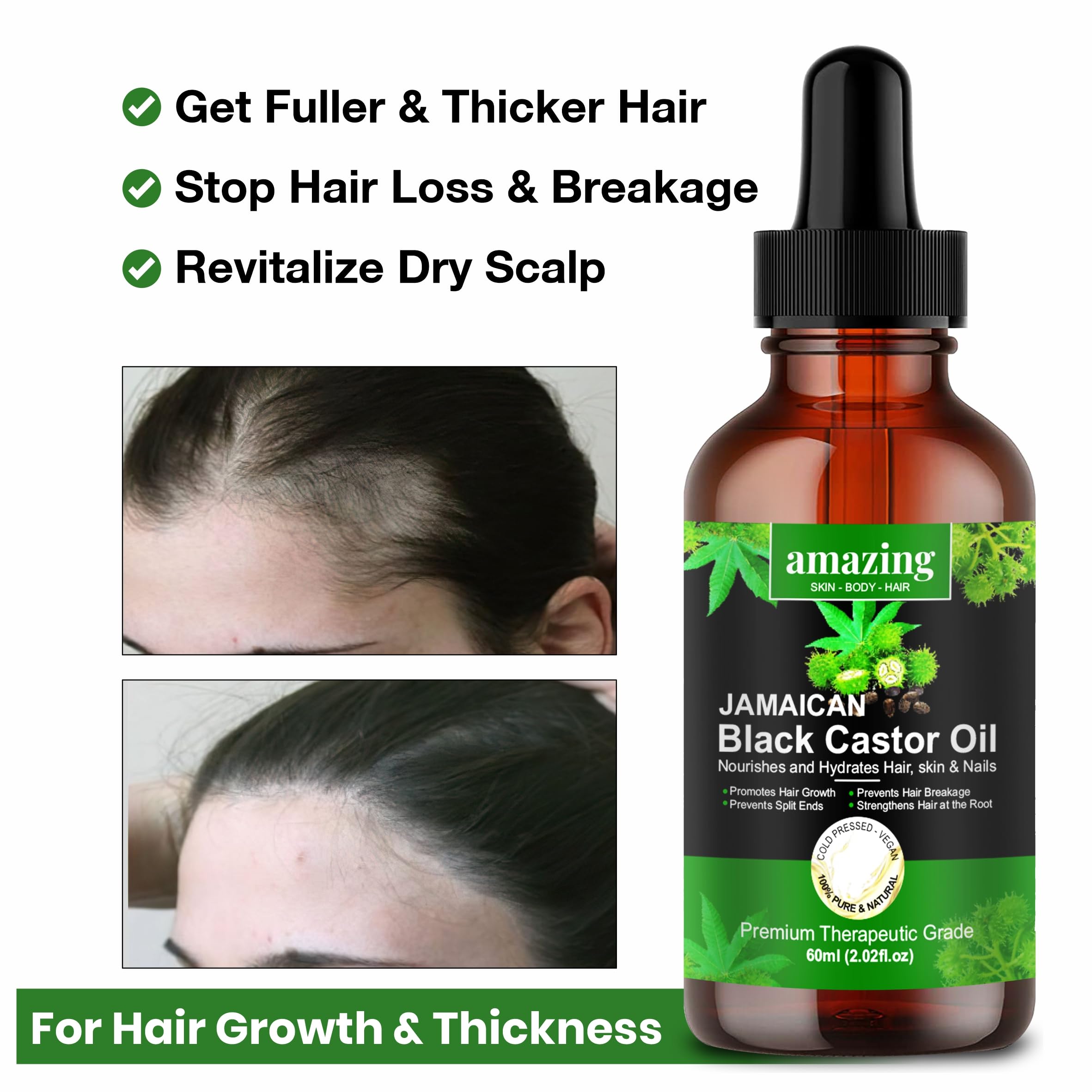 AmazingOrganics 100% Pure Black Jamaican Castor Oil - Unrefined Cold-Pressed for Hair Growth, Skin & Body Care | Natural Moisturizer for Dry Scalp, Eyelashes, Beard & Stretch Marks | Perfect for DIY Beauty Recipes & Massage Therapy
