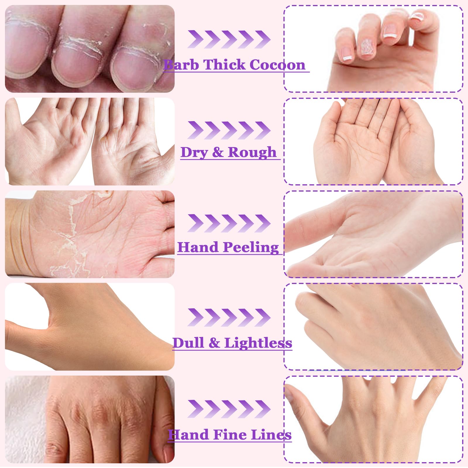 Permotary 6 Pack Moisturizing Hand Peel Mask Gloves - Natural Collagen Spa Gloves for Dry & Rough Skin Repair - Hydrating Hand Treatment for Women & Men (Lavender) | Perfect for At-Home Spa, Night Care & Gift Giving