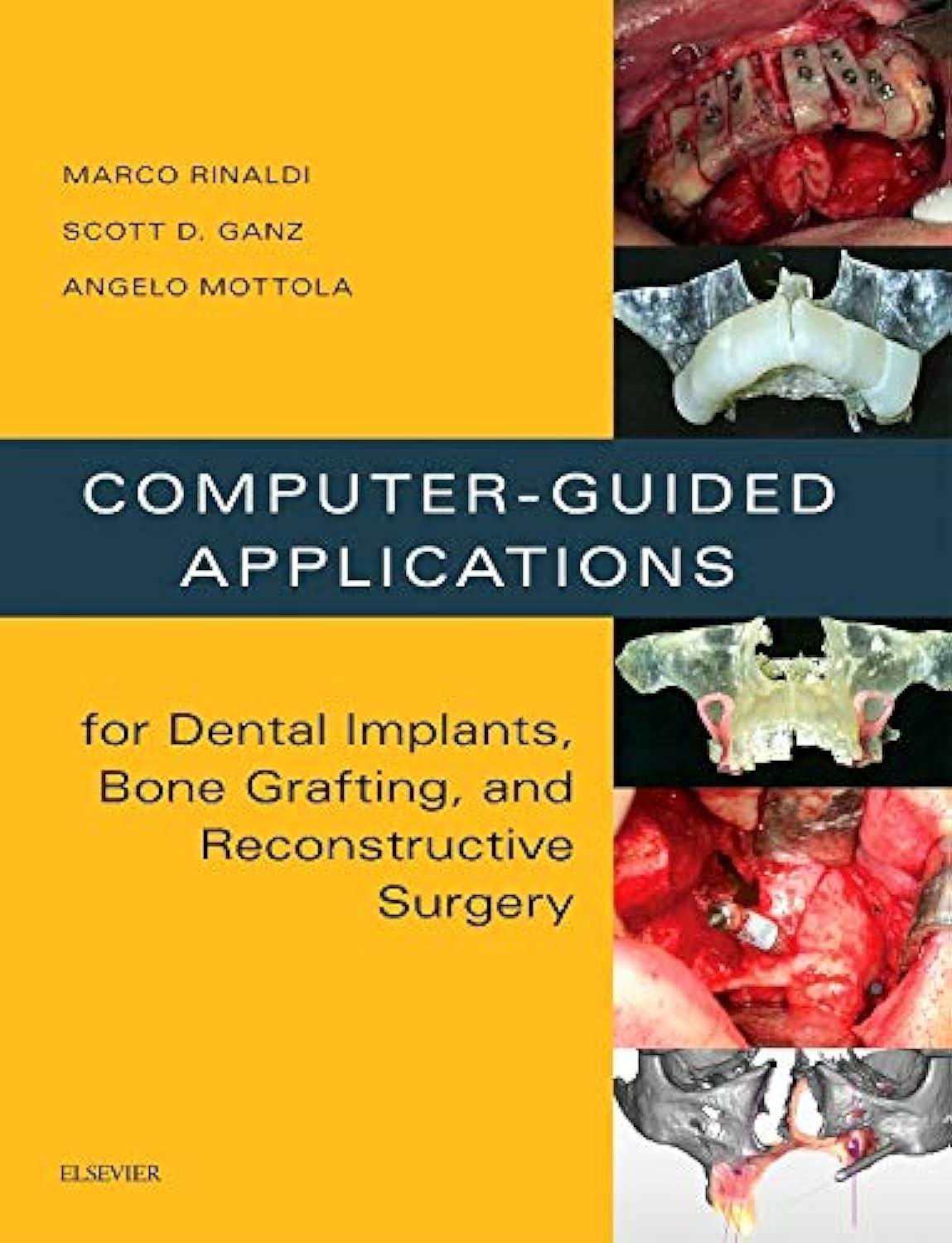 Computer-Guided Dental Implants, Bone Grafting & Reconstructive Surgery Tools | Precision Dental Surgery Equipment for Dentists & Oral Surgeons | Perfect for Dental Clinics, Implant Procedures & Jaw Reconstruction