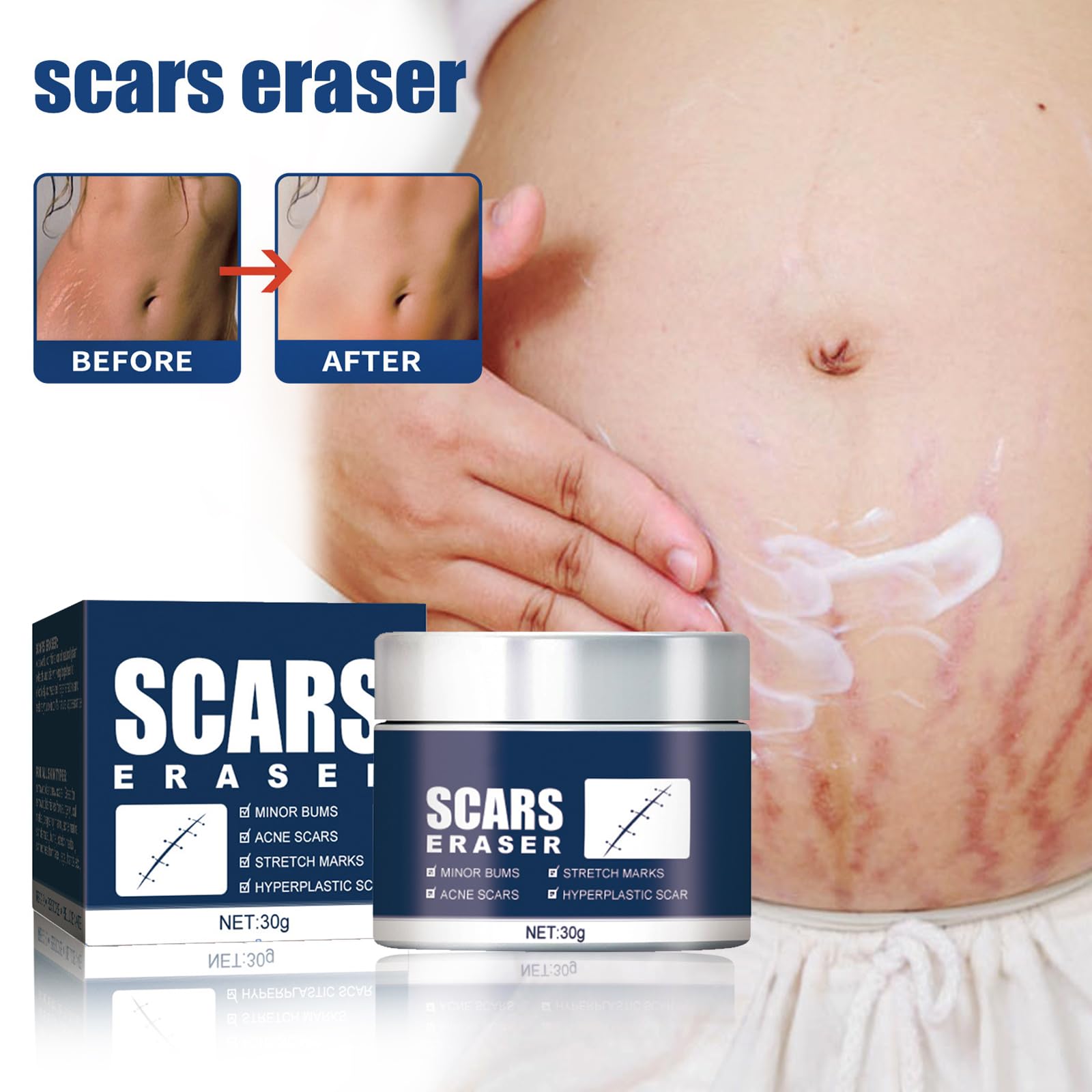 Premium Scar Repair Cream for Face & Body - Medical Grade Scar Removal Treatment for Surgery, Acne, Burns & Injuries - Post-Op Healing Ointment for Smooth Skin Recovery - Ideal for Daily Use After Wounds & Cosmetic Procedures