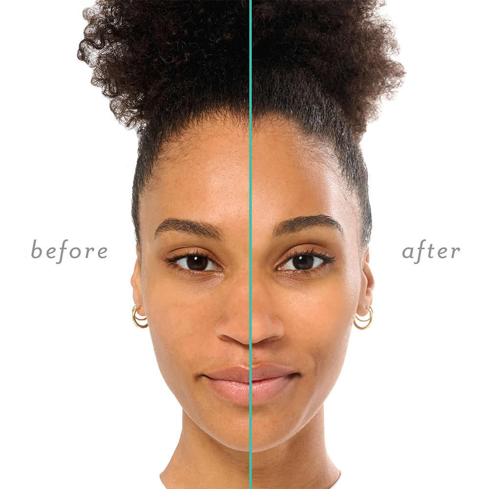 Patchology Skincare Booster - Hydrating & Revitalizing Face Mask for Glowing Skin | Perfect for Spa Nights & Self-Care Routines