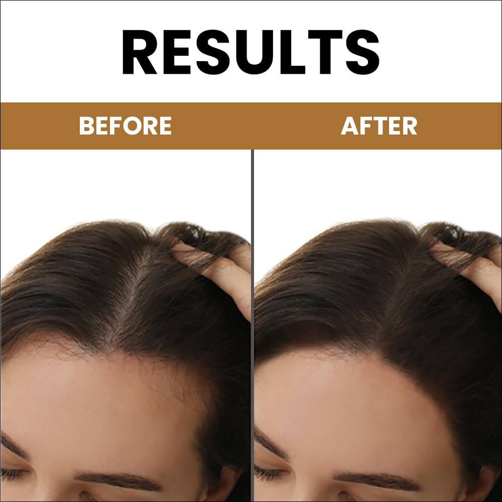 MyUpchar Ayurveda KeshArt Bhringraj Hair Cleanser Shampoo 200ml - Natural Hair Loss Treatment with Hibiscus & Rosemary | Paraben & SLS Free | 100% Ayurvedic Formula for Stronger Hair | Perfect for Daily Hair Care & Scalp Nourishment
